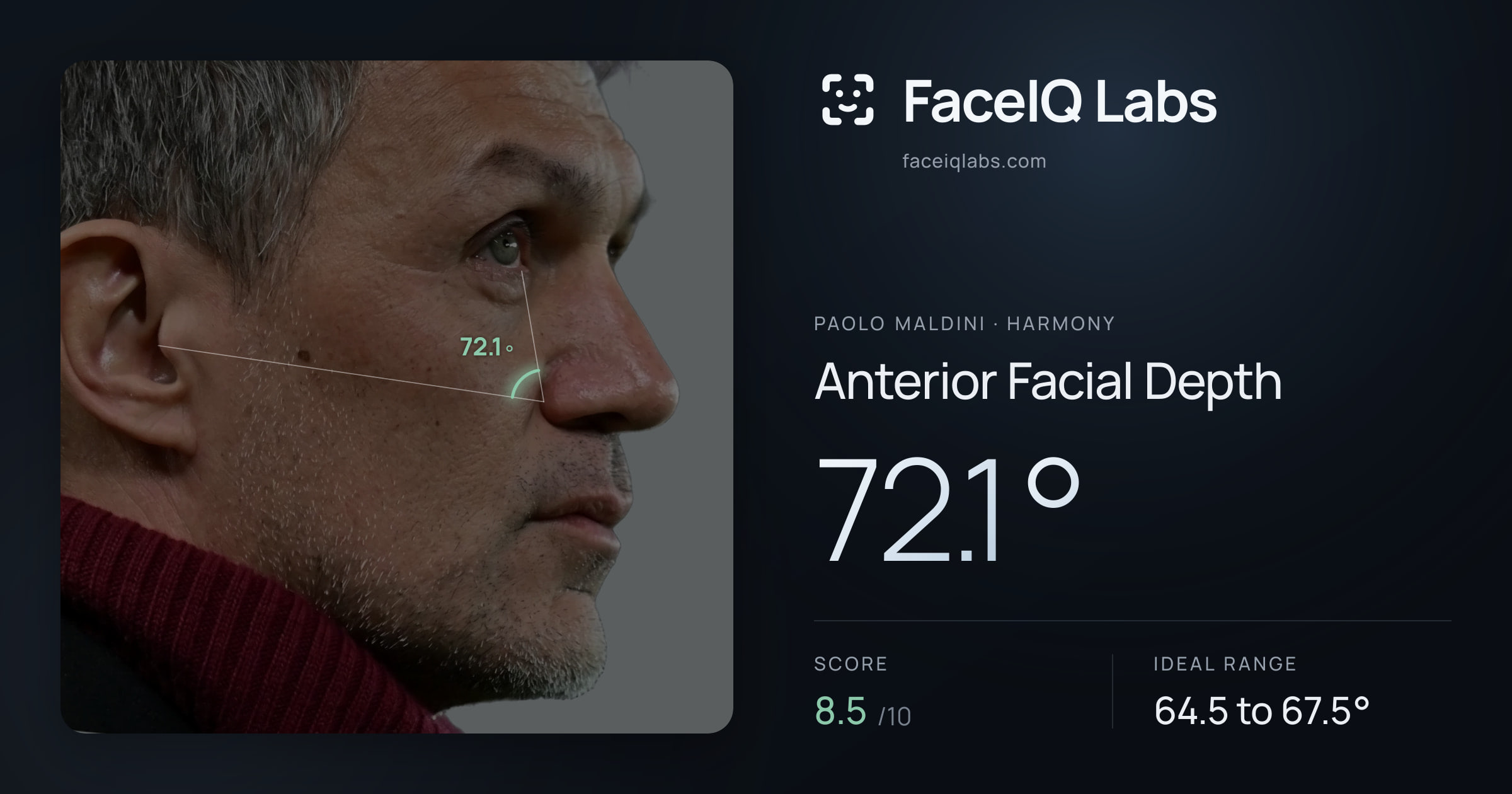 Paolo Maldini Anterior Facial Depth: 72.1°, drawn on the photo