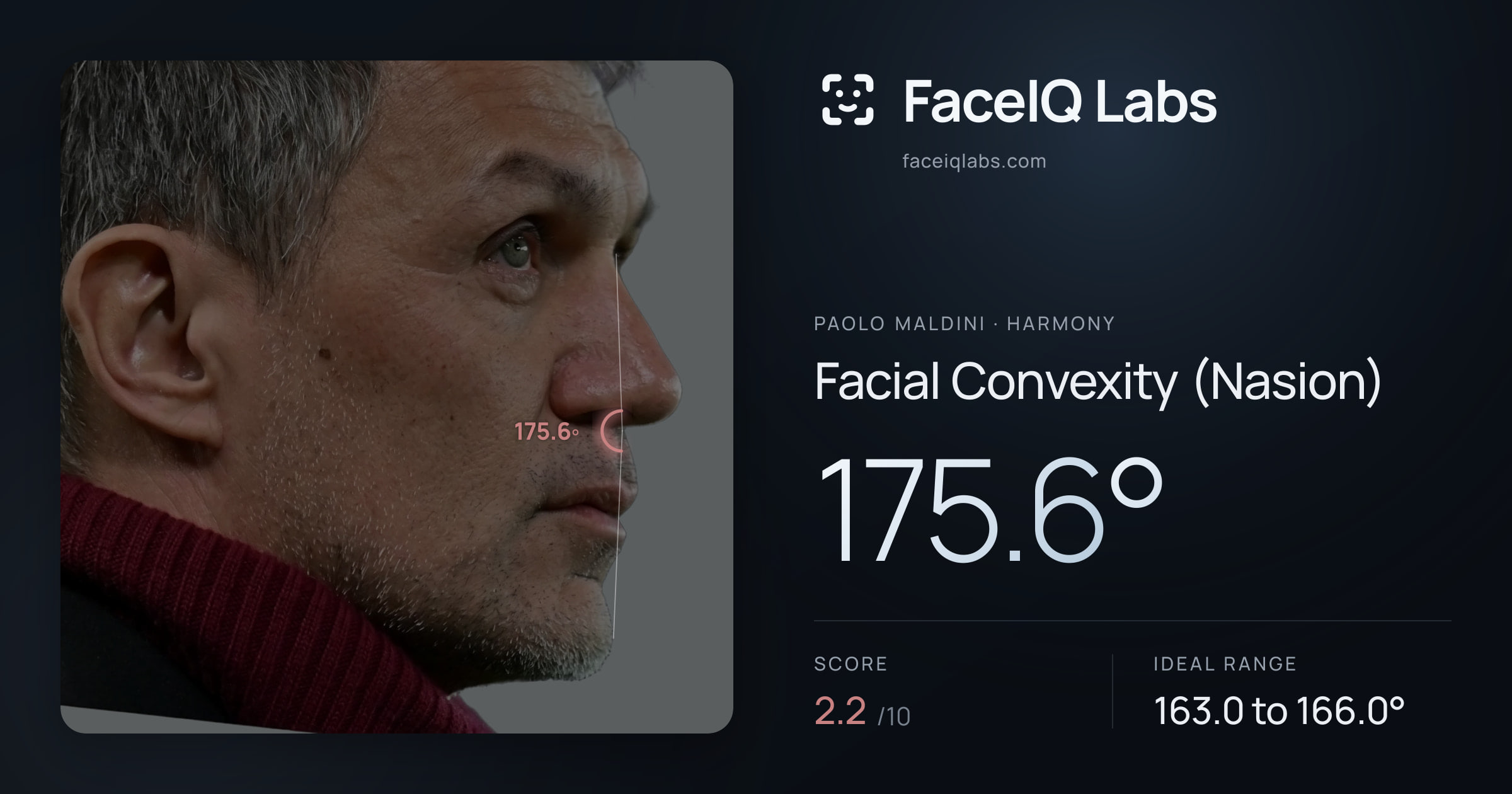Paolo Maldini Facial Convexity (Nasion): 175.6°, drawn on the photo