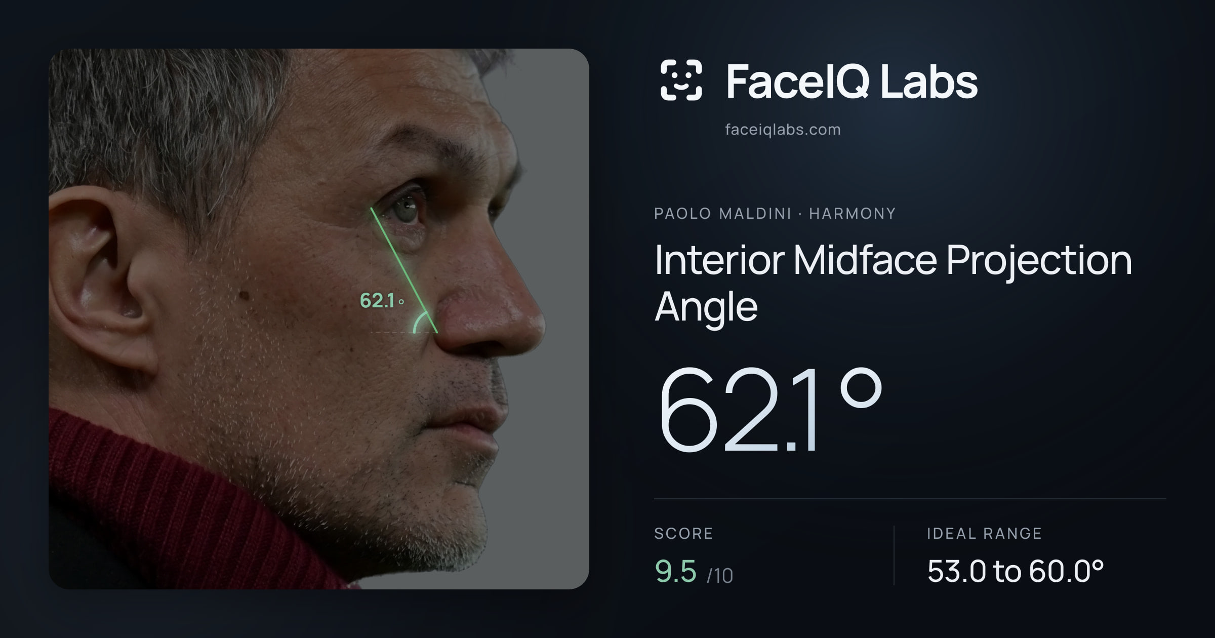 Paolo Maldini Interior Midface Projection Angle: 62.1°, drawn on the photo