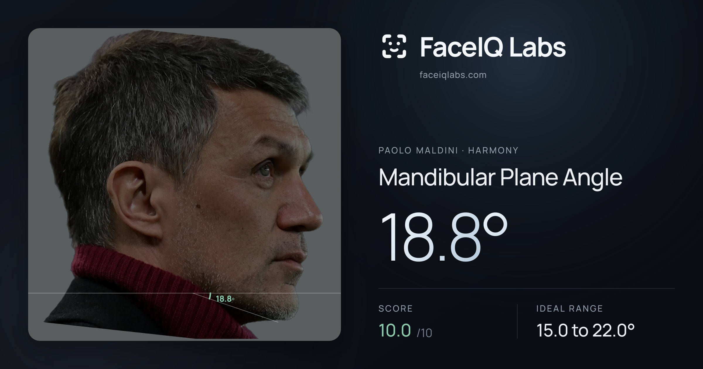 Paolo Maldini Mandibular Plane Angle: 18.8°, drawn on the photo