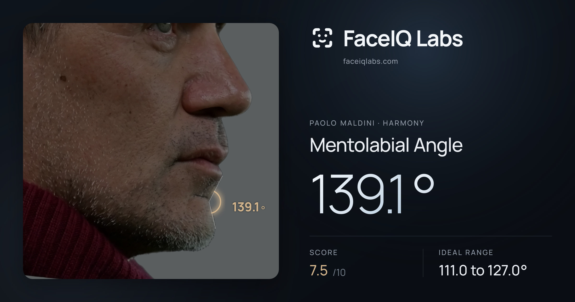 Paolo Maldini Mentolabial Angle: 139.1°, drawn on the photo