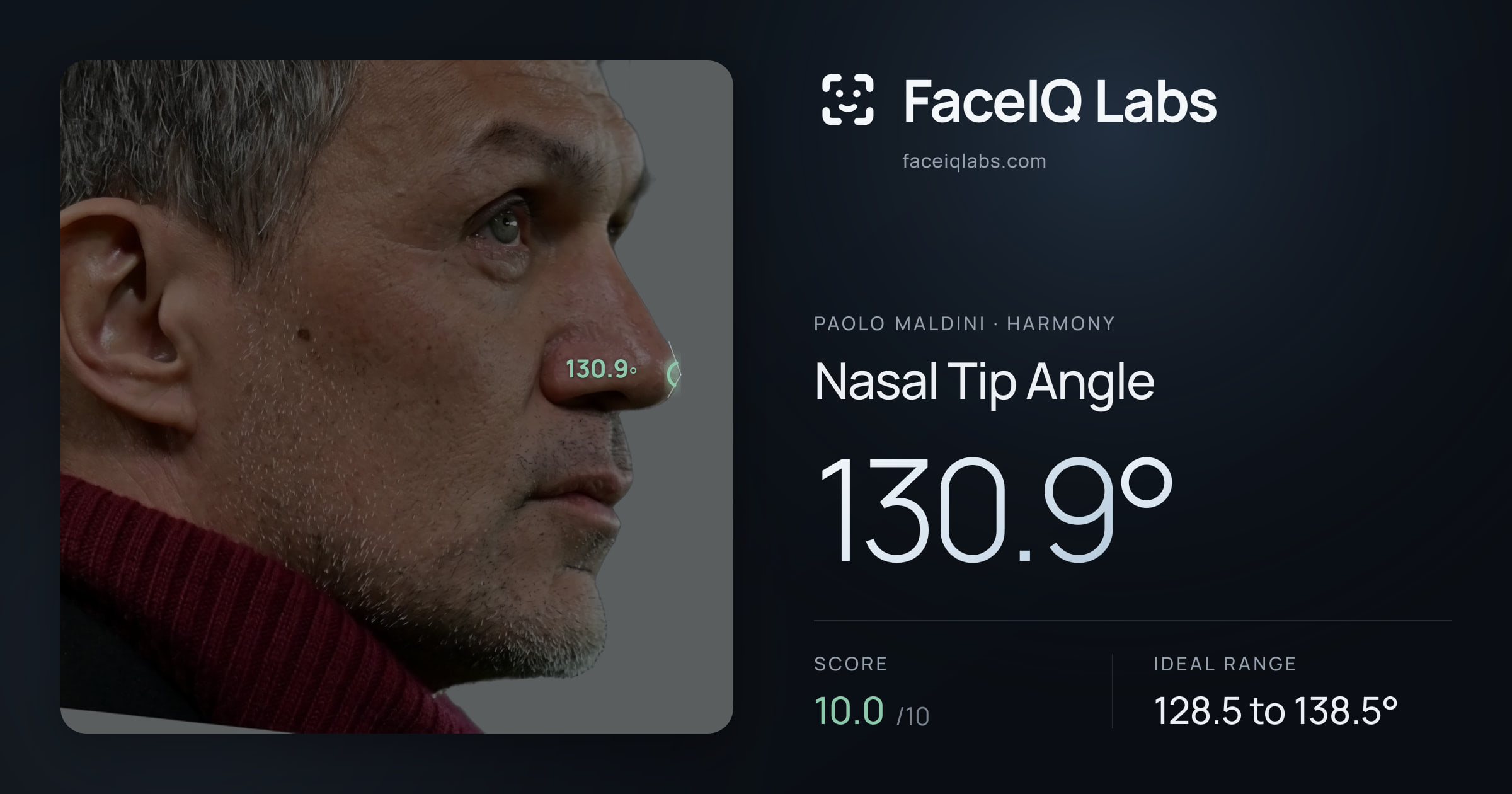 Paolo Maldini Nasal Tip Angle: 130.9°, drawn on the photo