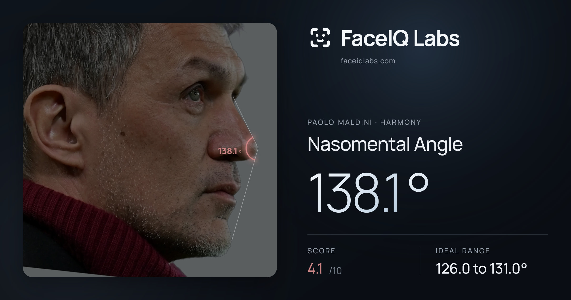 Paolo Maldini Nasomental Angle: 138.1°, drawn on the photo