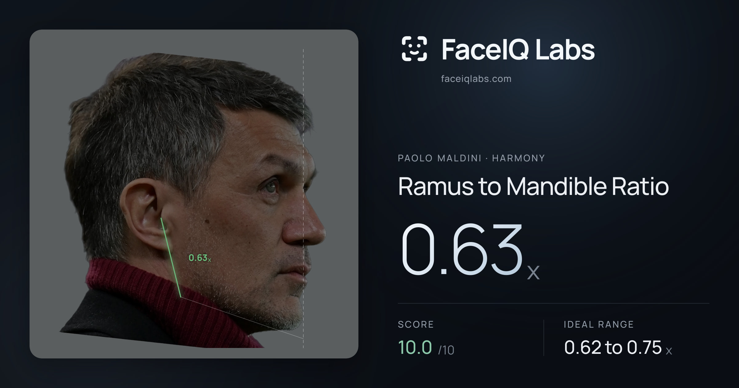Paolo Maldini Ramus to Mandible Ratio: 0.63x, drawn on the photo