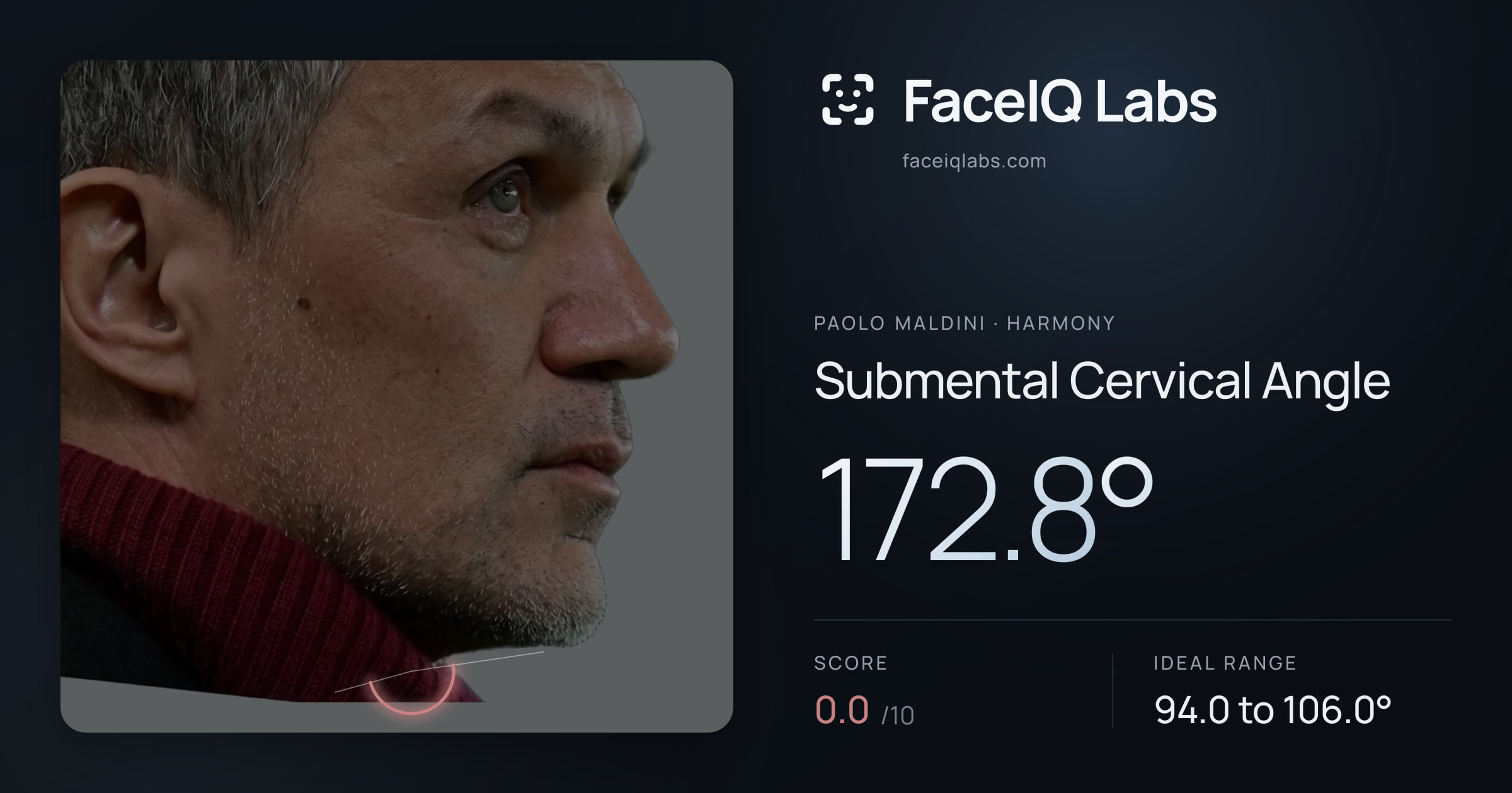 Paolo Maldini Submental Cervical Angle: 172.8°, drawn on the photo