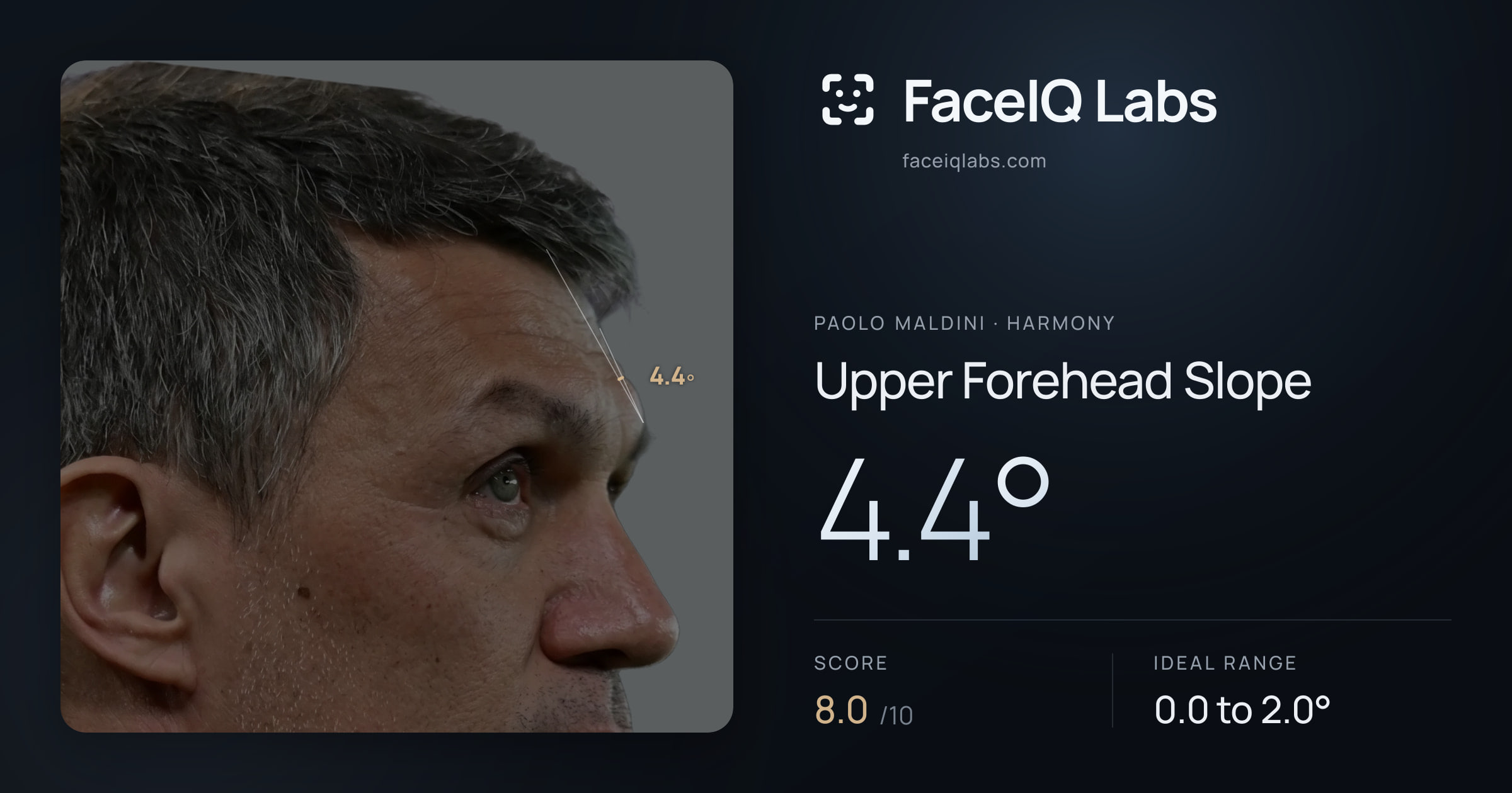 Paolo Maldini Upper Forehead Slope: 4.4°, drawn on the photo