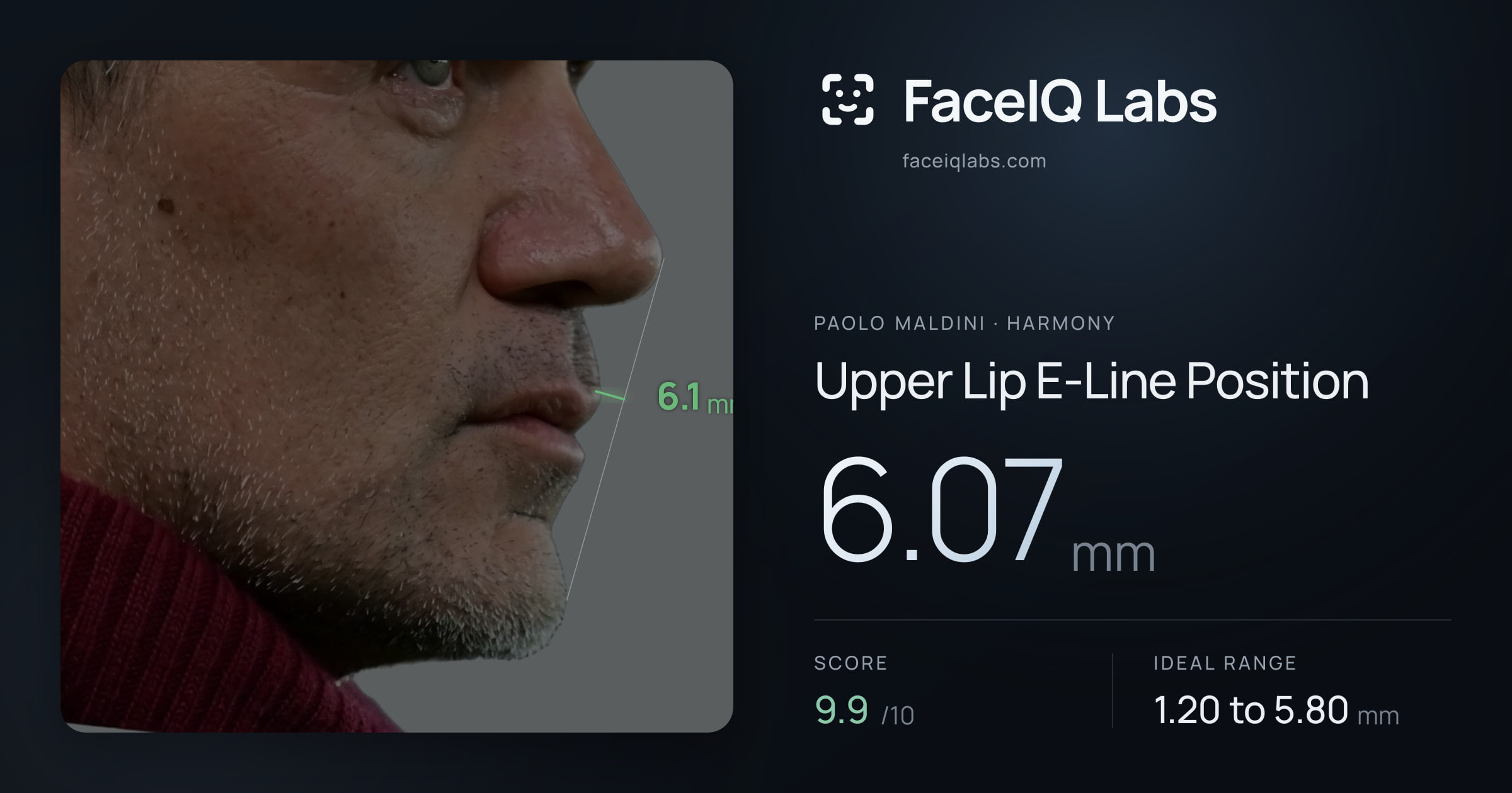 Paolo Maldini Upper Lip E-Line Position: 6.07mm, drawn on the photo