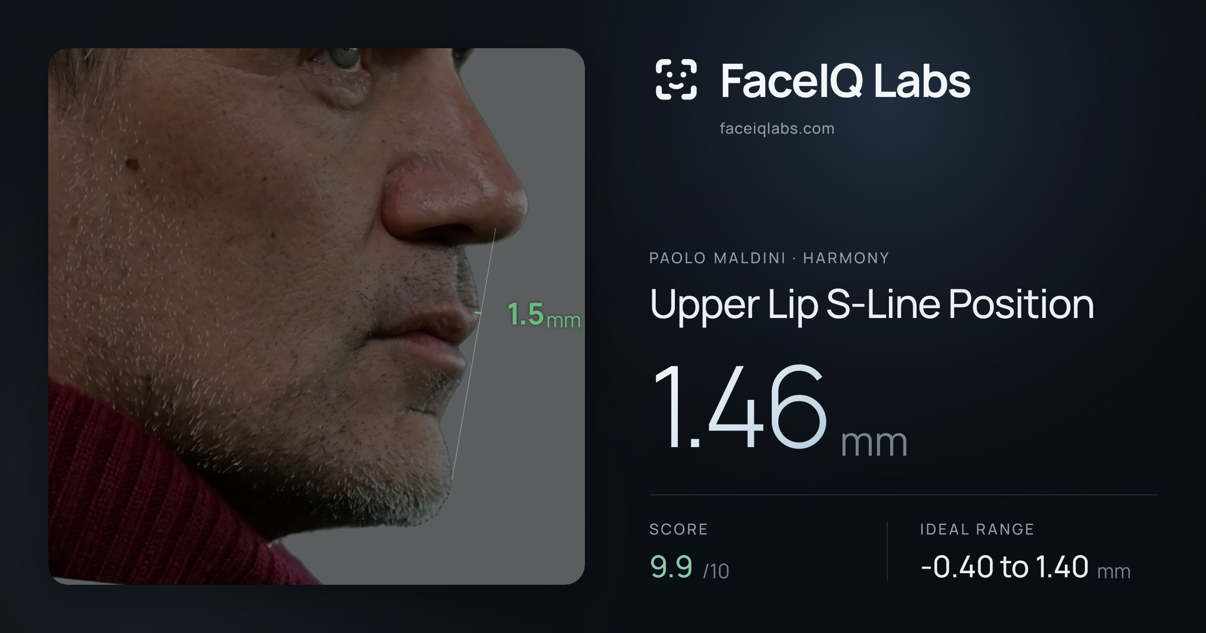 Paolo Maldini Upper Lip S-Line Position: 1.46mm, drawn on the photo