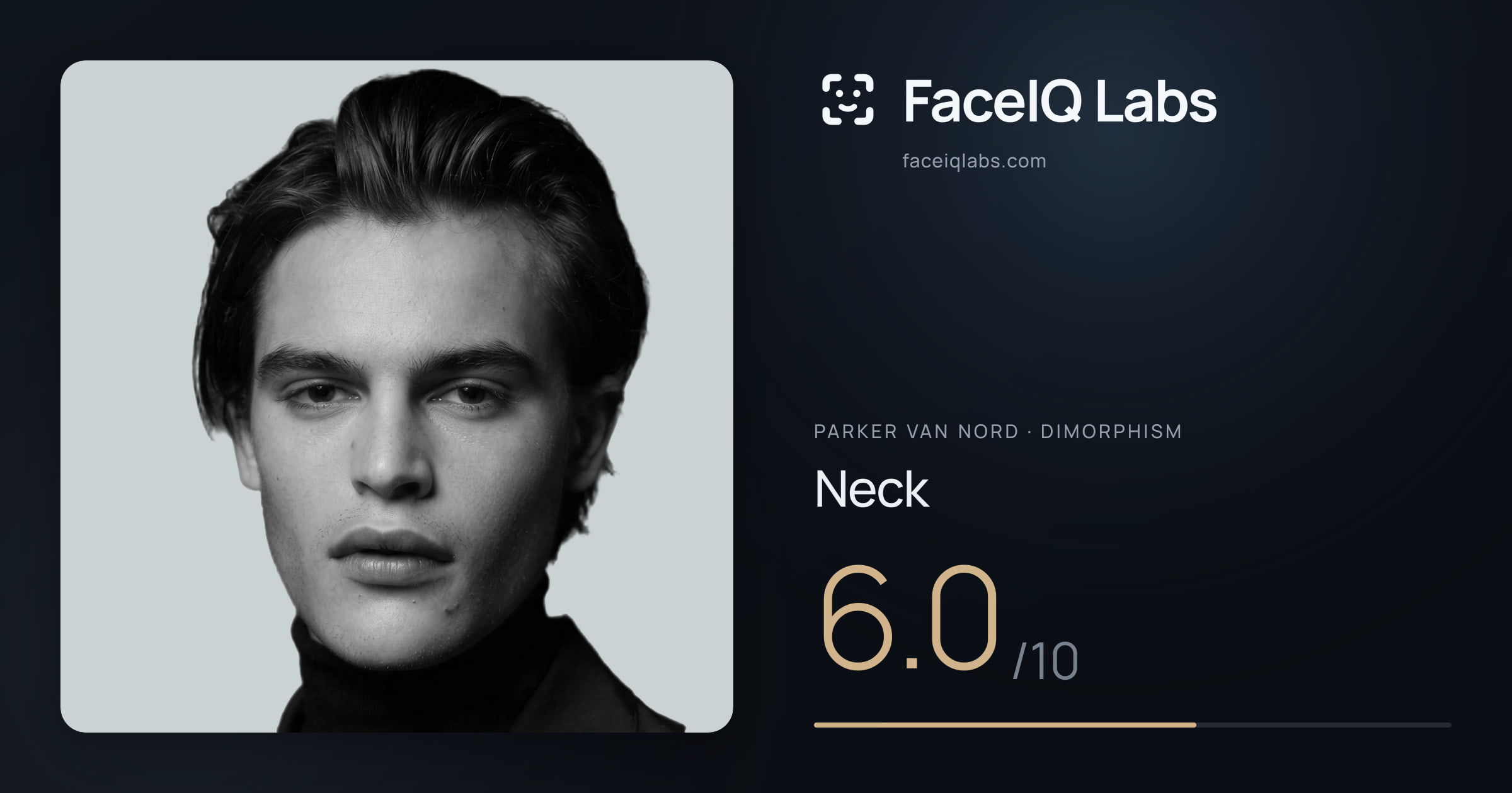 Parker Van Nord Neck: 6.0/10, drawn on the photo