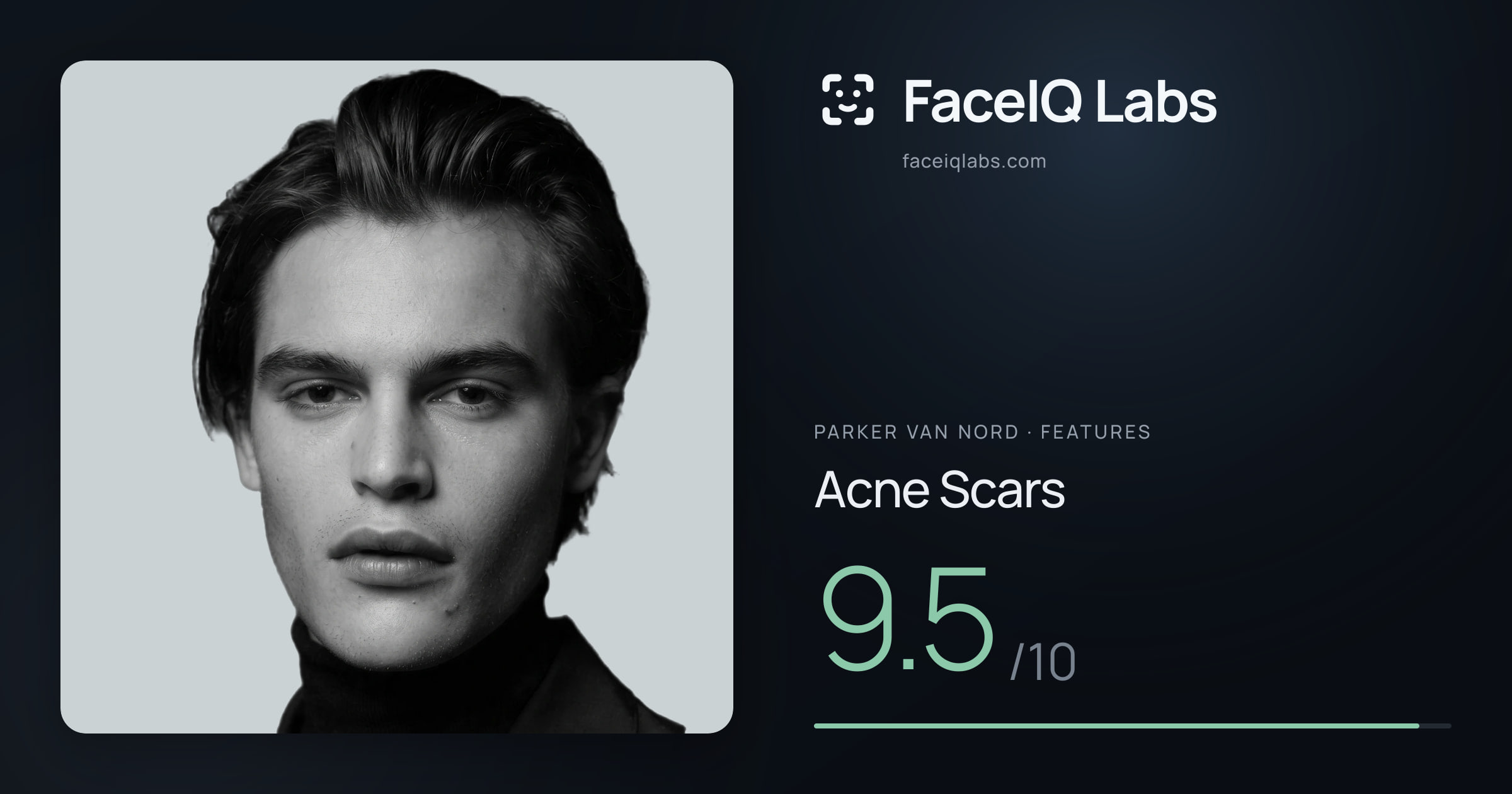 Parker Van Nord Acne Scars: 9.5/10, drawn on the photo