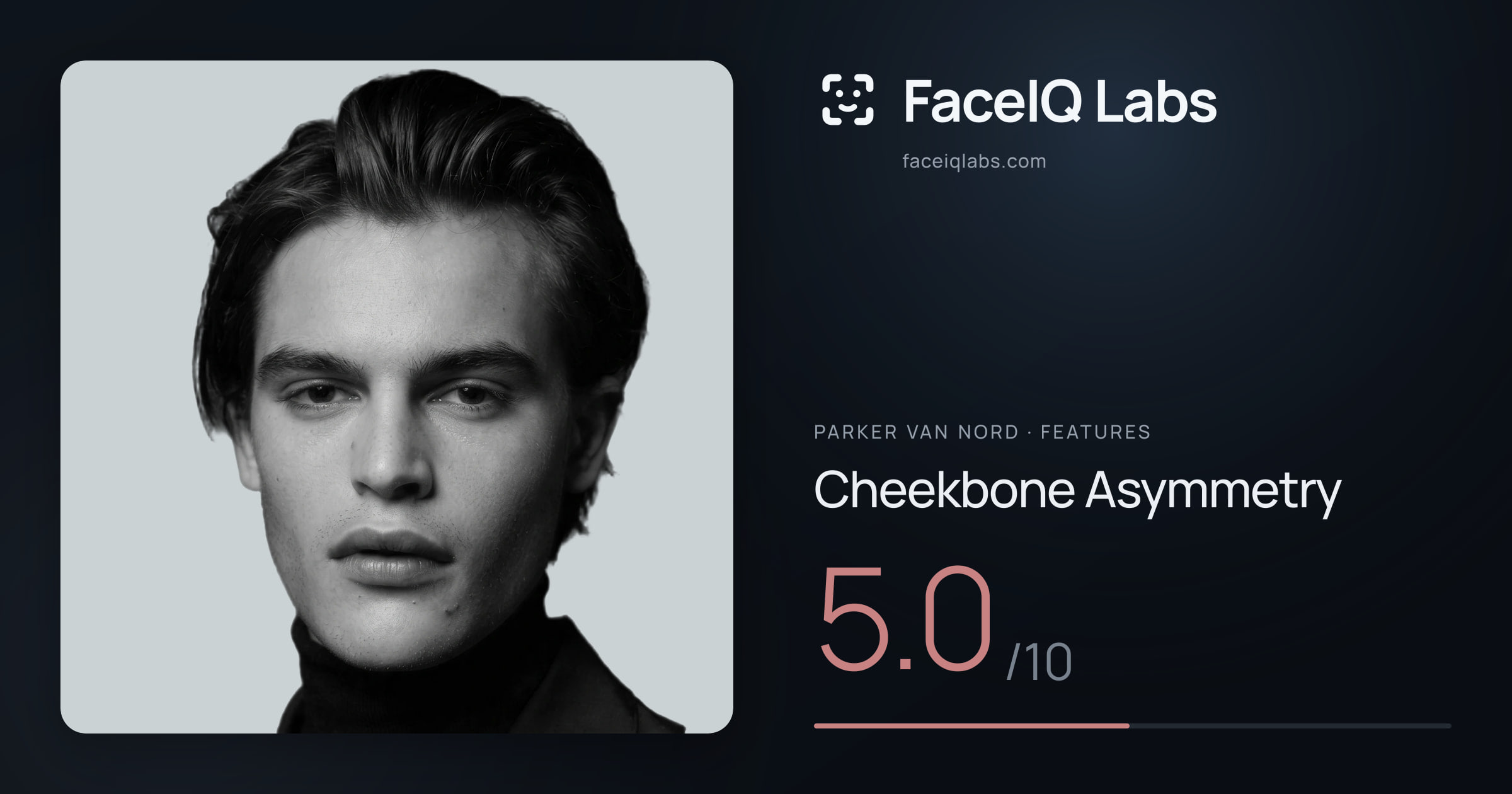 Parker Van Nord Cheekbone Asymmetry: 5.0/10, drawn on the photo