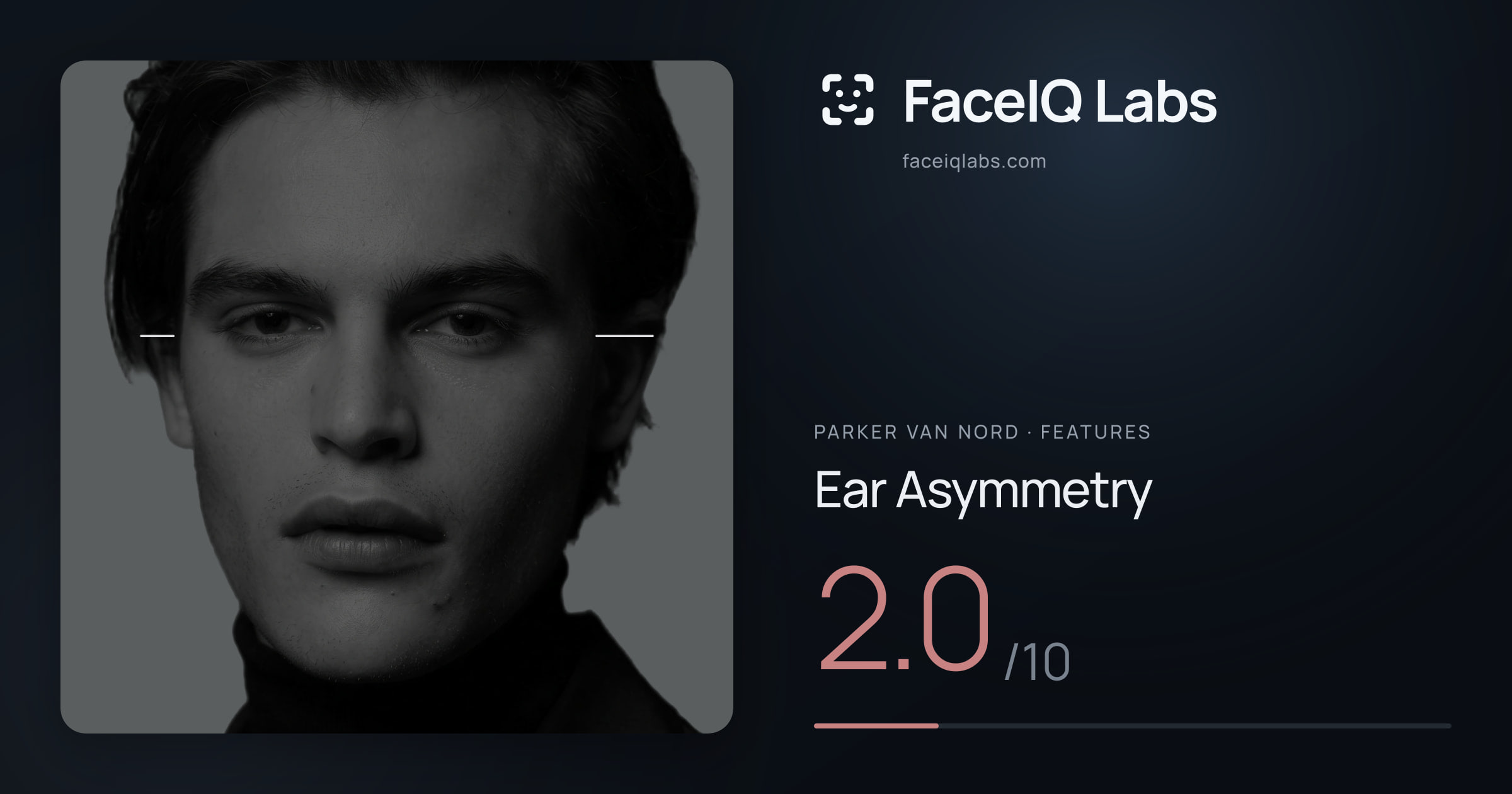 Parker Van Nord Ear Asymmetry: 2.0/10, drawn on the photo