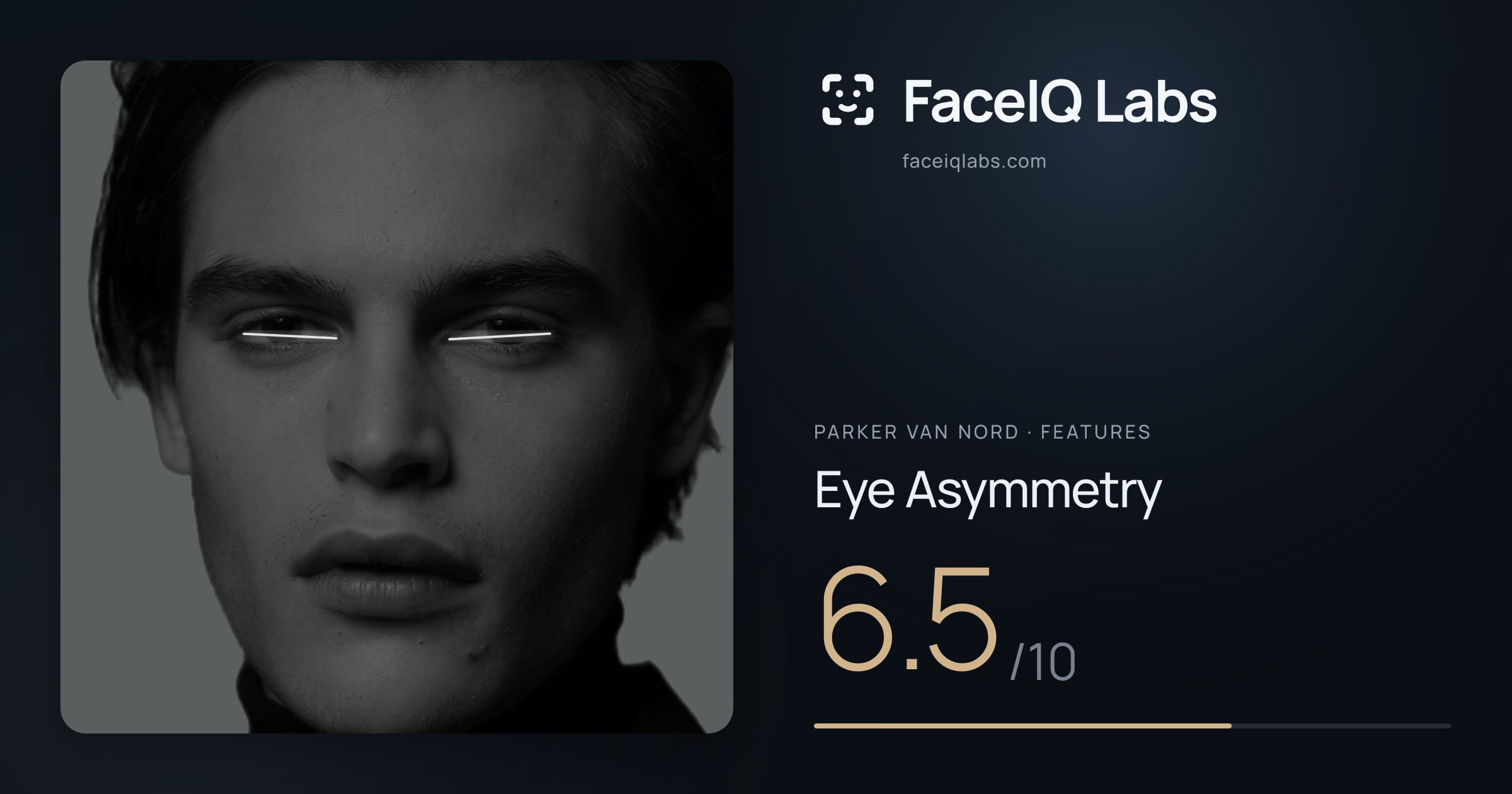 Parker Van Nord Eye Asymmetry: 6.5/10, drawn on the photo