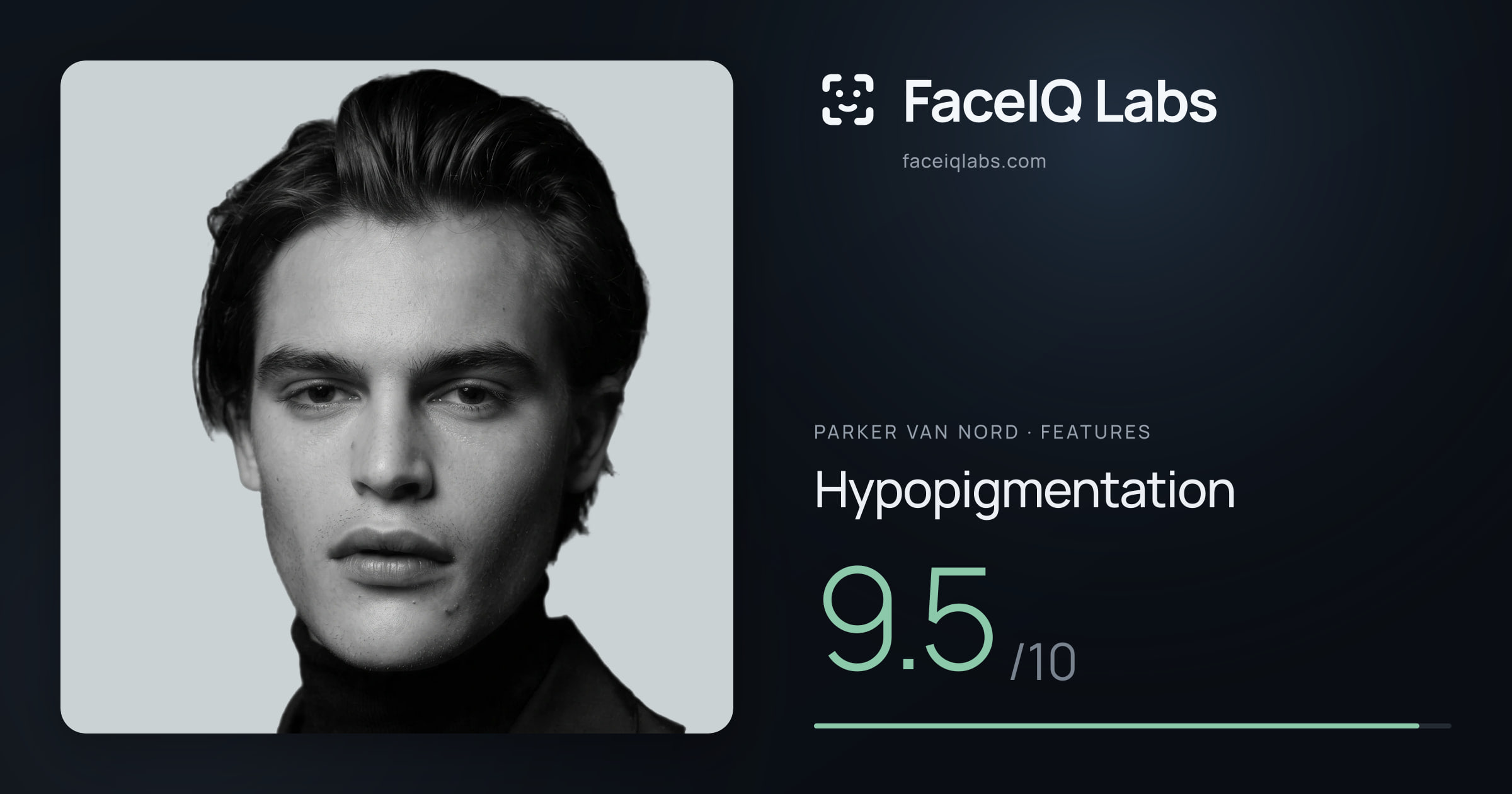 Parker Van Nord Hypopigmentation: 9.5/10, drawn on the photo