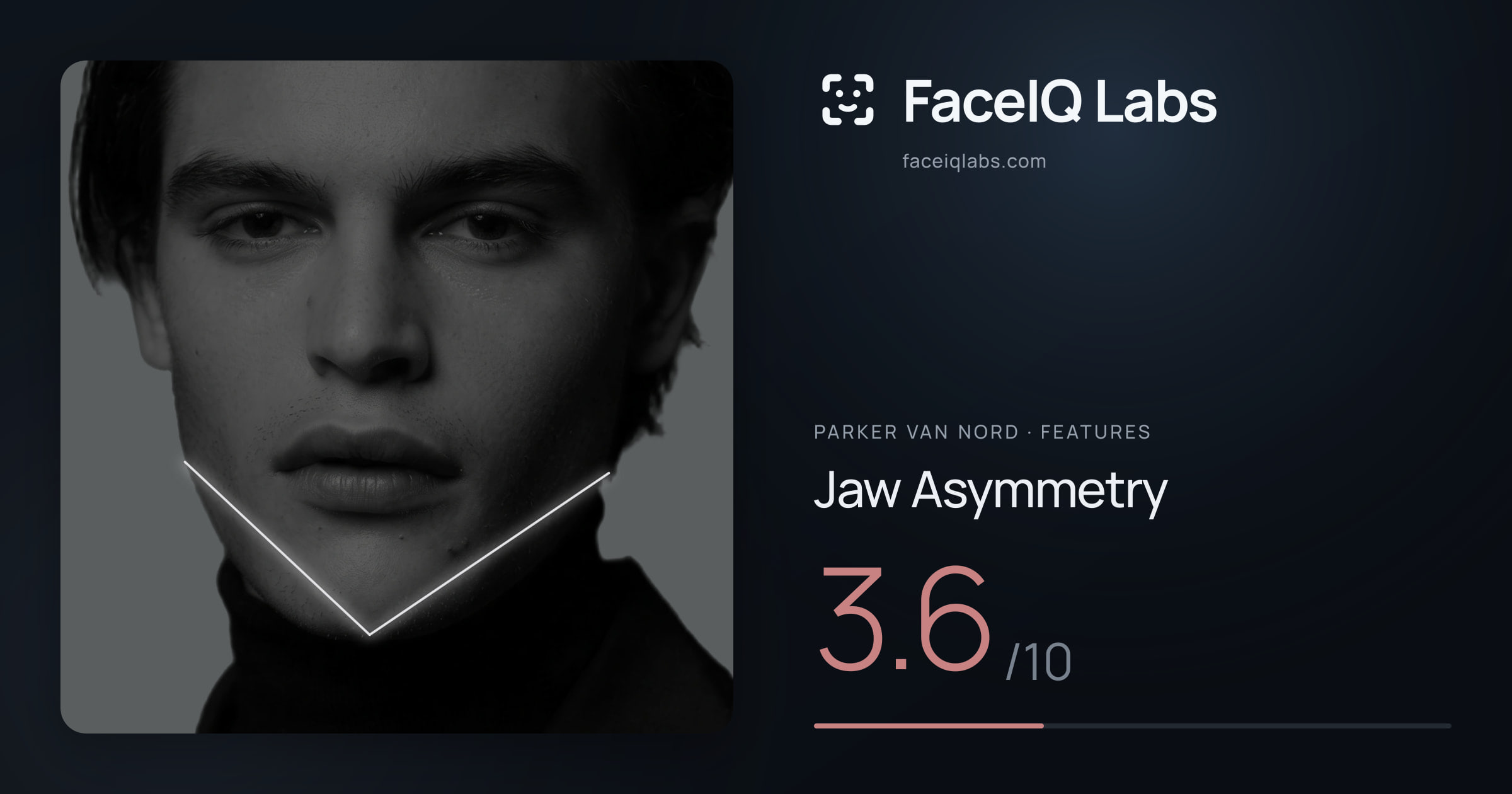 Parker Van Nord Jaw Asymmetry: 3.6/10, drawn on the photo