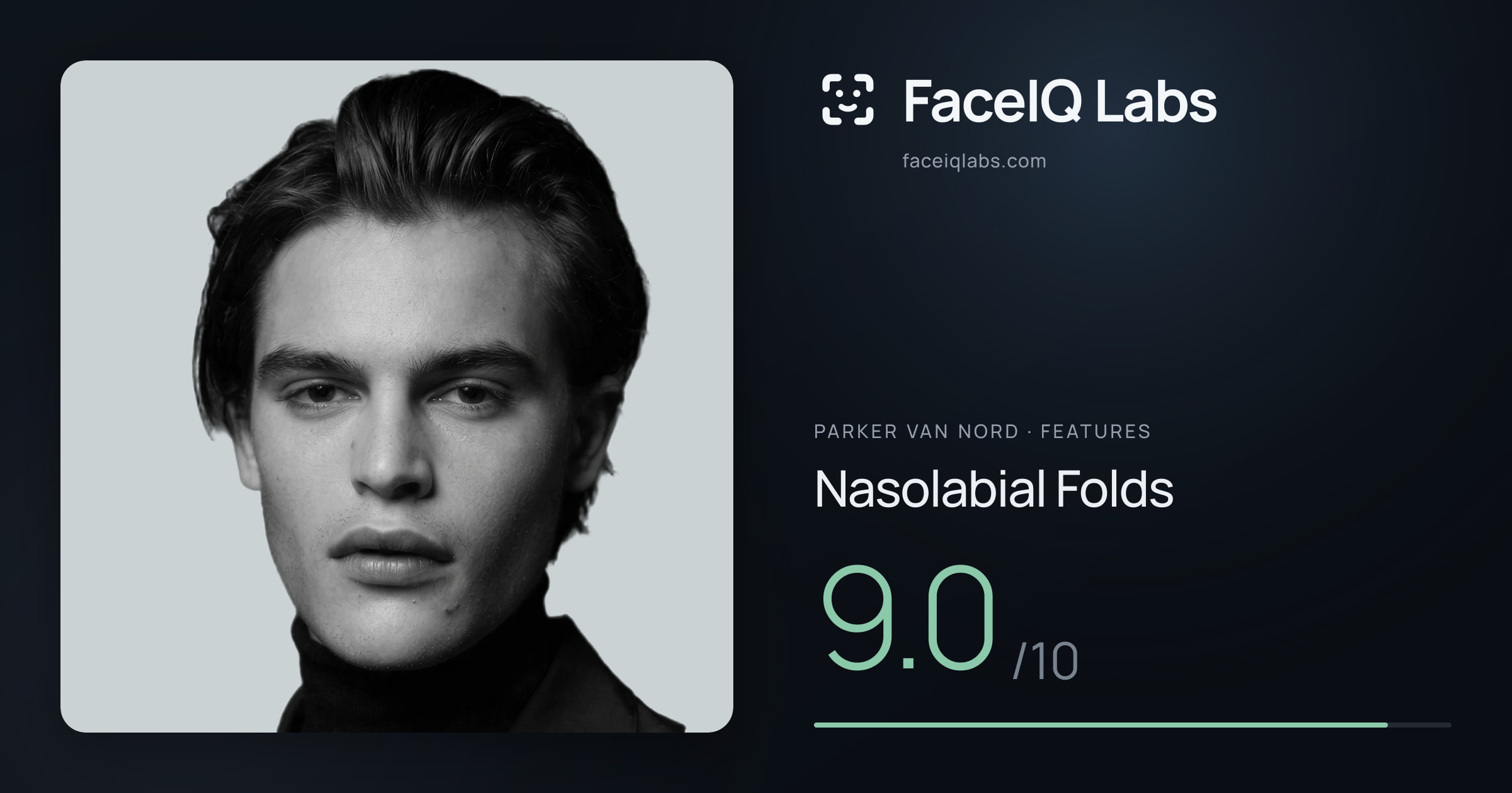 Parker Van Nord Nasolabial Folds: 9.0/10, drawn on the photo
