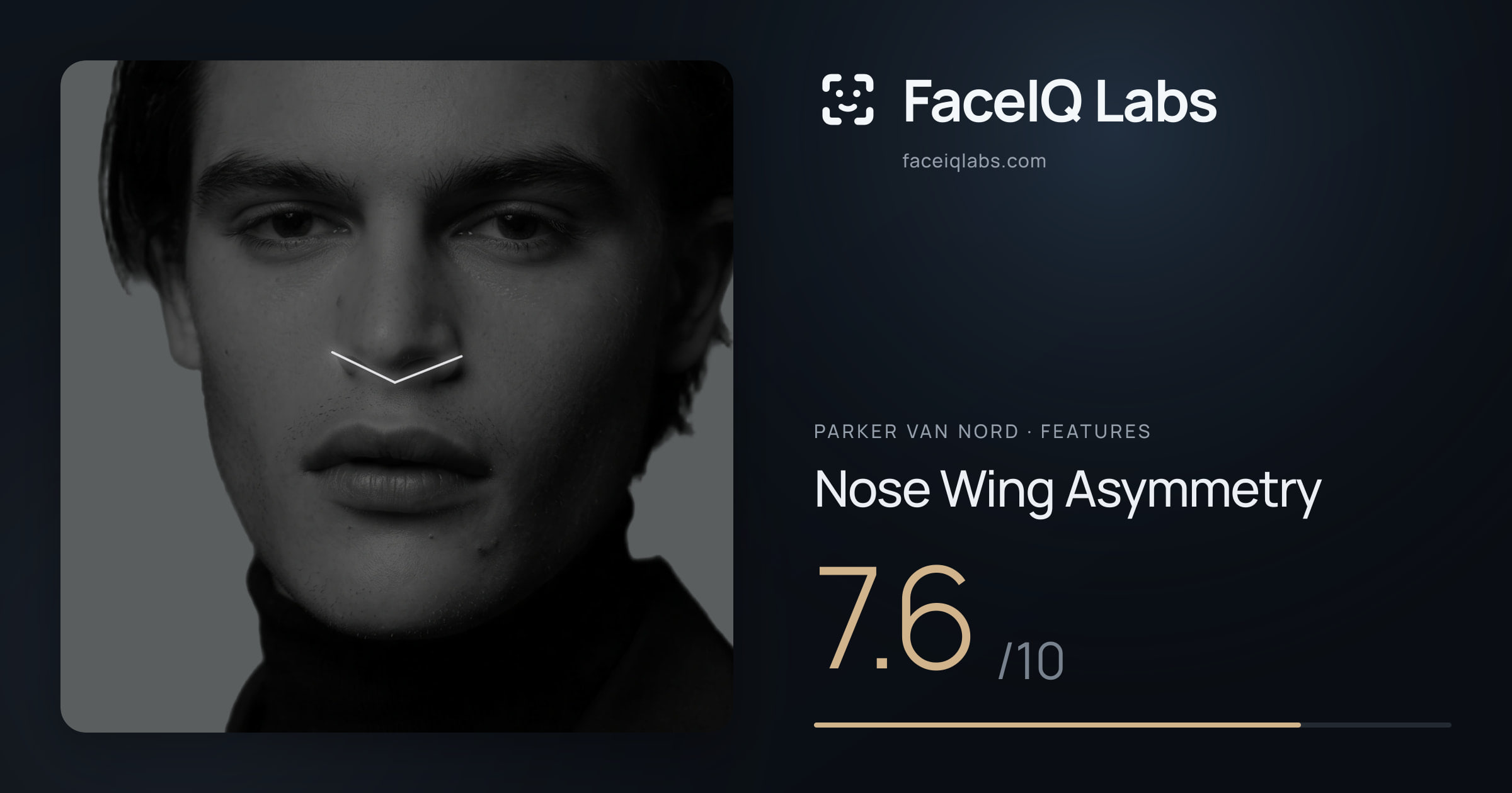 Parker Van Nord Nose Wing Asymmetry: 7.6/10, drawn on the photo
