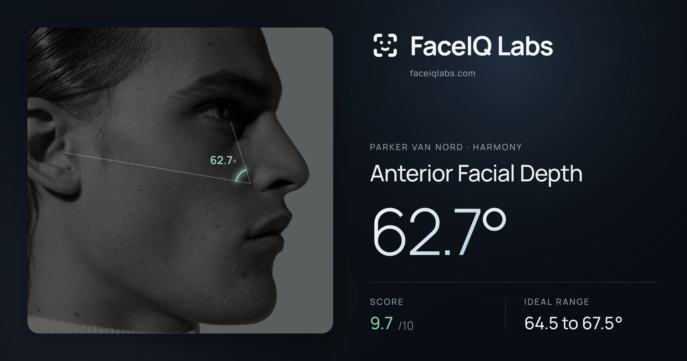 Parker Van Nord Anterior Facial Depth: 62.7°, drawn on the photo