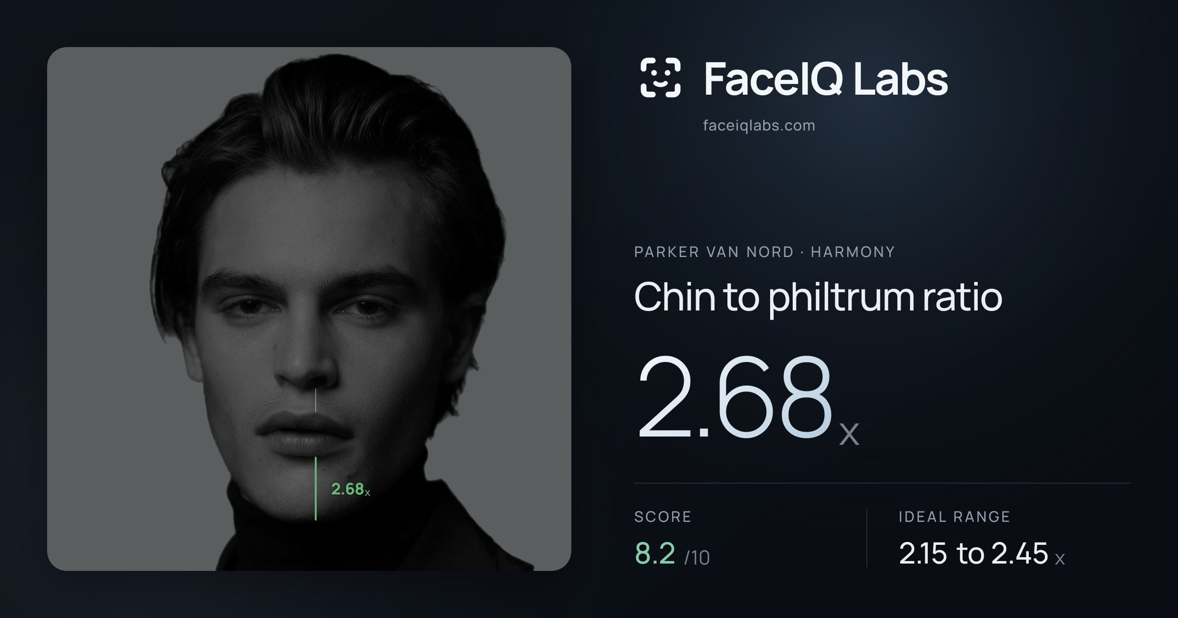 Parker Van Nord Chin to philtrum ratio: 2.68x, drawn on the photo