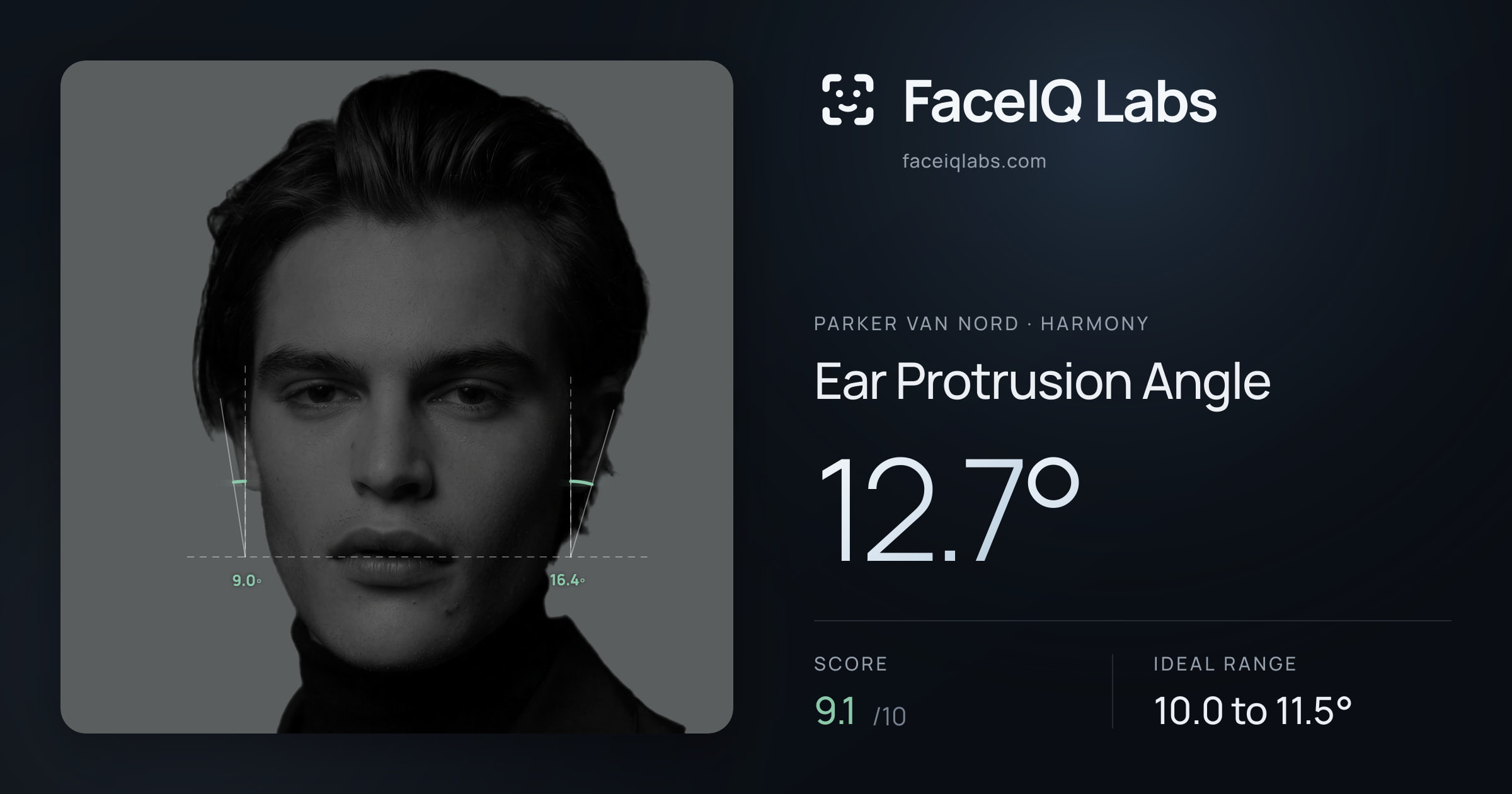 Parker Van Nord Ear Protrusion Angle: 12.7°, drawn on the photo