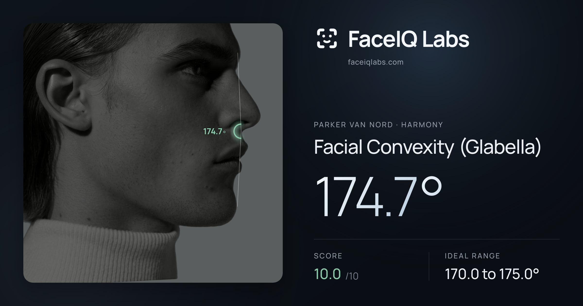 Parker Van Nord Facial Convexity (Glabella): 174.7°, drawn on the photo