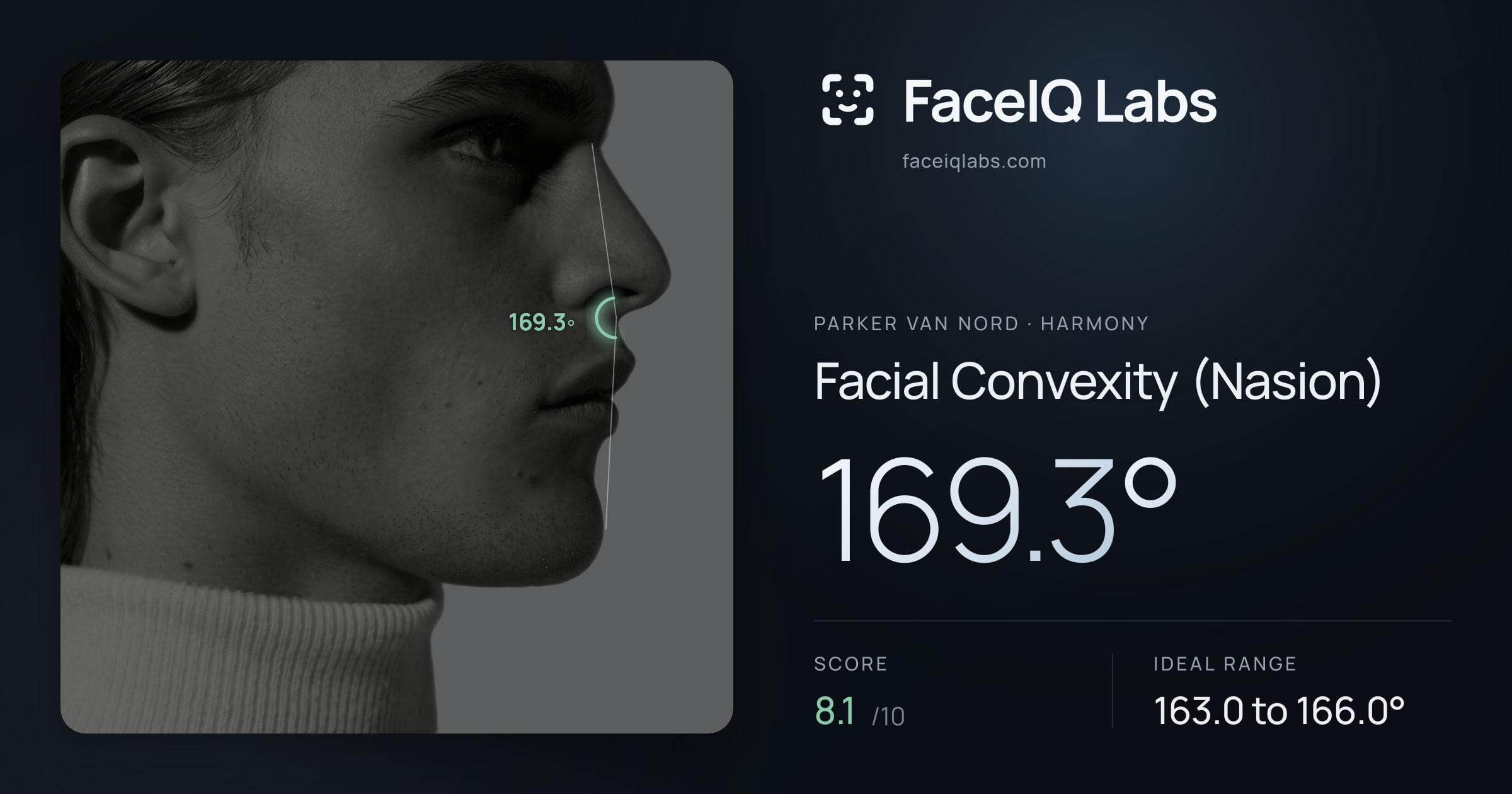Parker Van Nord Facial Convexity (Nasion): 169.3°, drawn on the photo