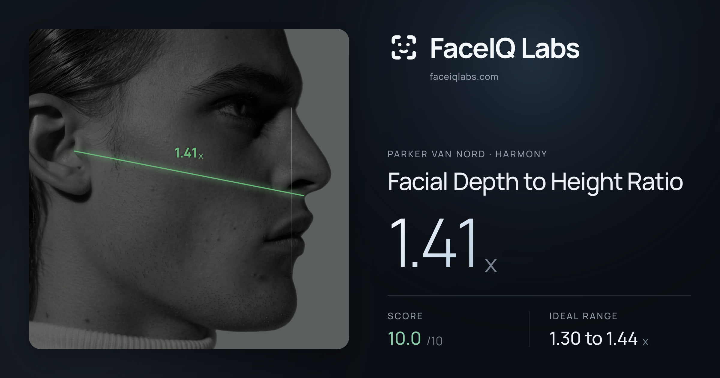 Parker Van Nord Facial Depth to Height Ratio: 1.41x, drawn on the photo