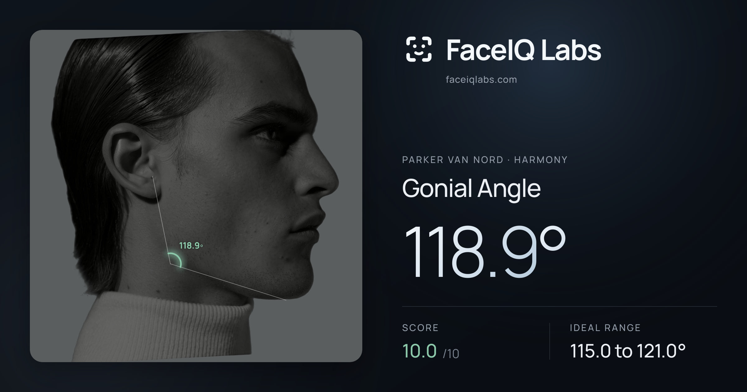 Parker Van Nord Gonial Angle: 118.9°, drawn on the photo