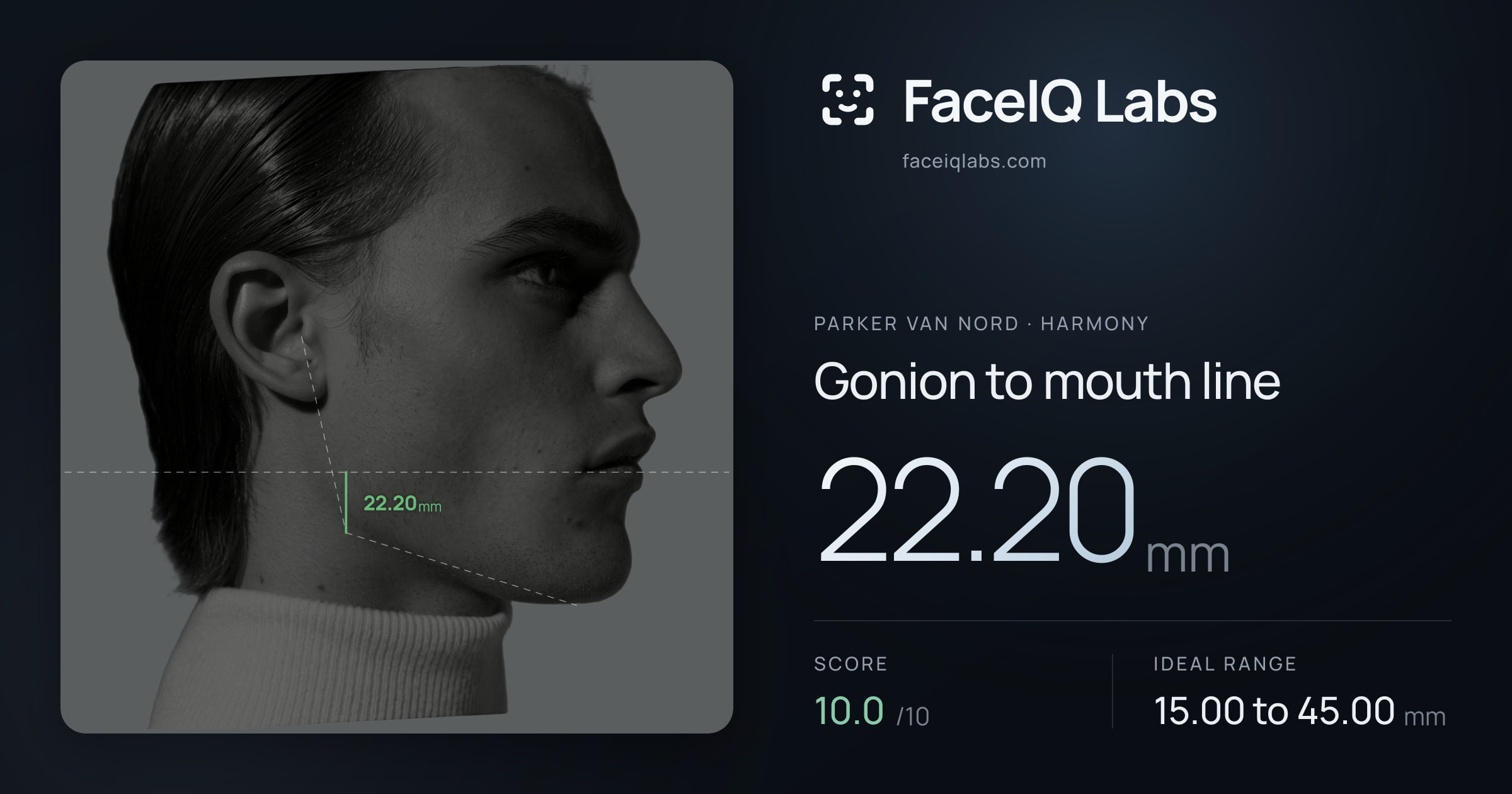 Parker Van Nord Gonion to mouth line: 22.20mm, drawn on the photo