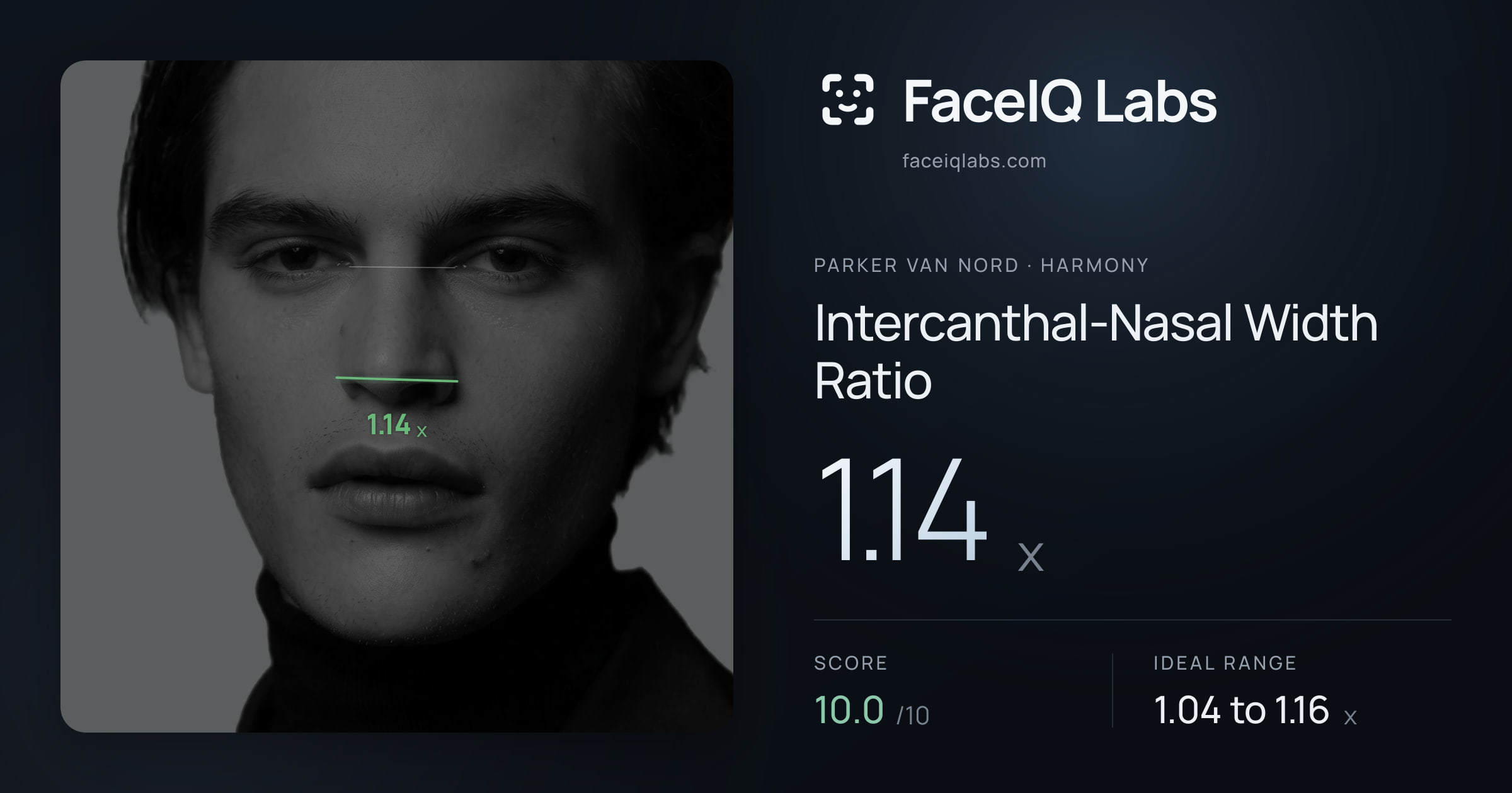 Parker Van Nord Intercanthal-Nasal Width Ratio: 1.14x, drawn on the photo