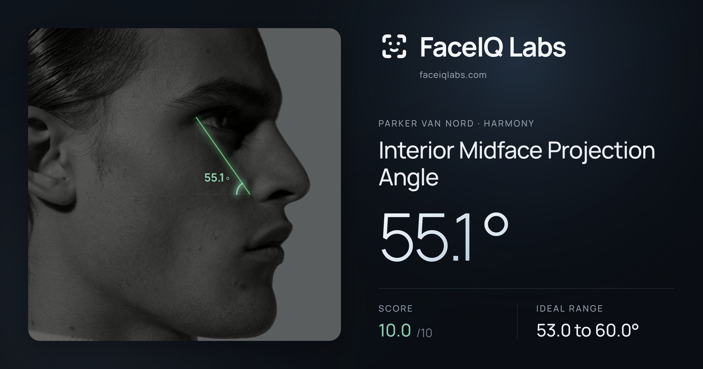Parker Van Nord Interior Midface Projection Angle: 55.1°, drawn on the photo