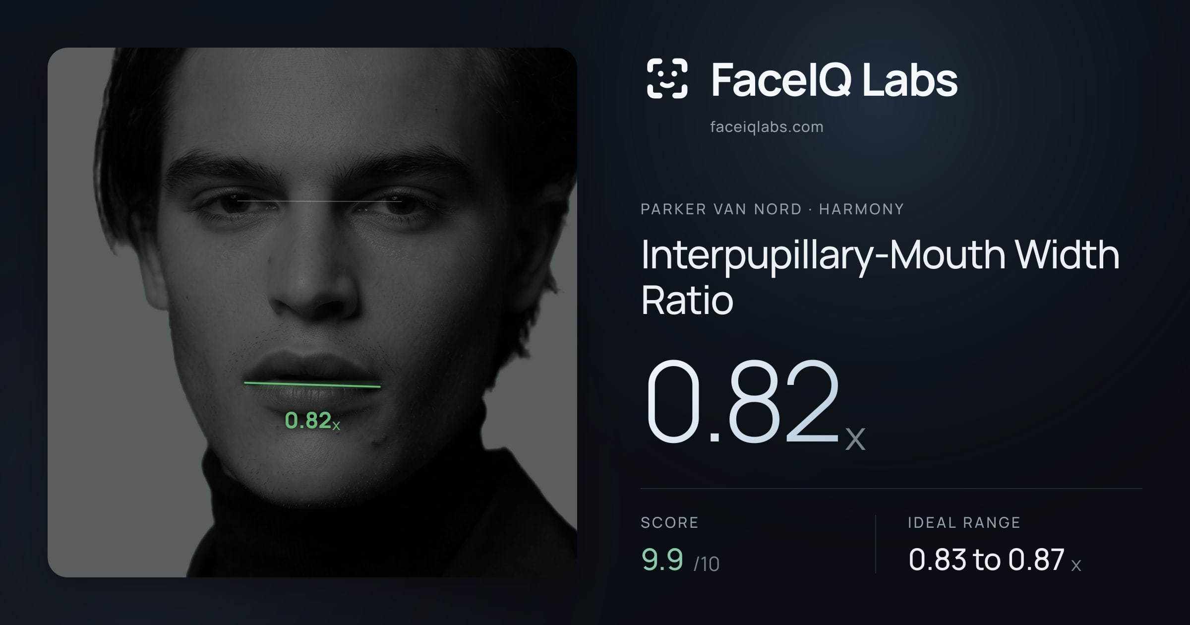 Parker Van Nord Interpupillary-Mouth Width Ratio: 0.82x, drawn on the photo