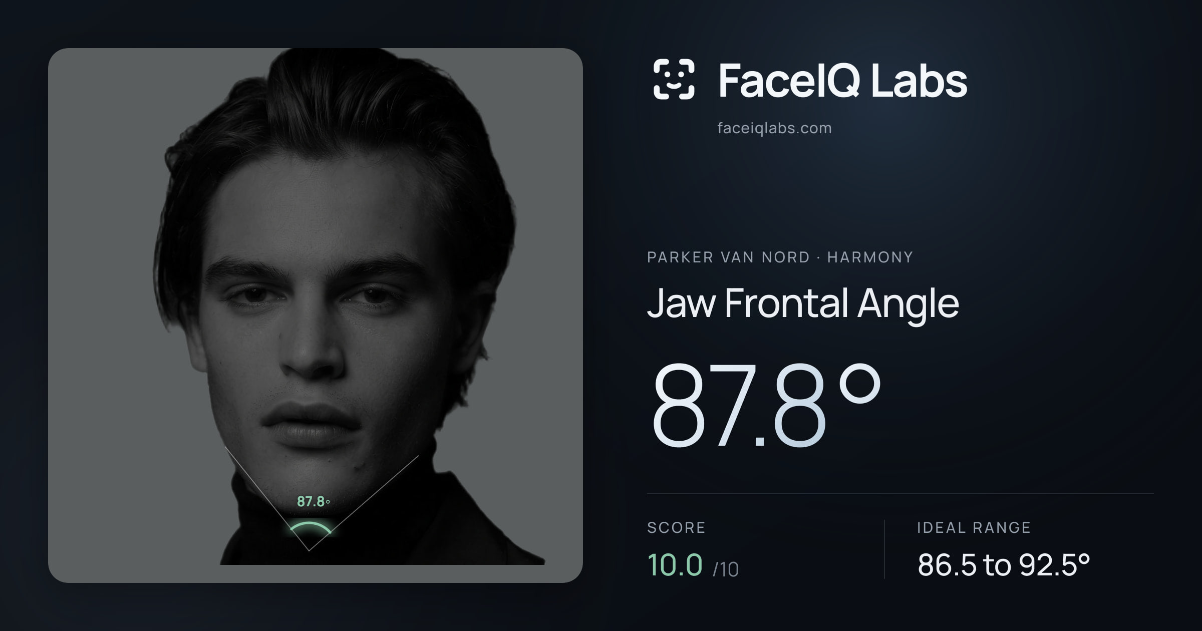 Parker Van Nord Jaw Frontal Angle: 87.8°, drawn on the photo