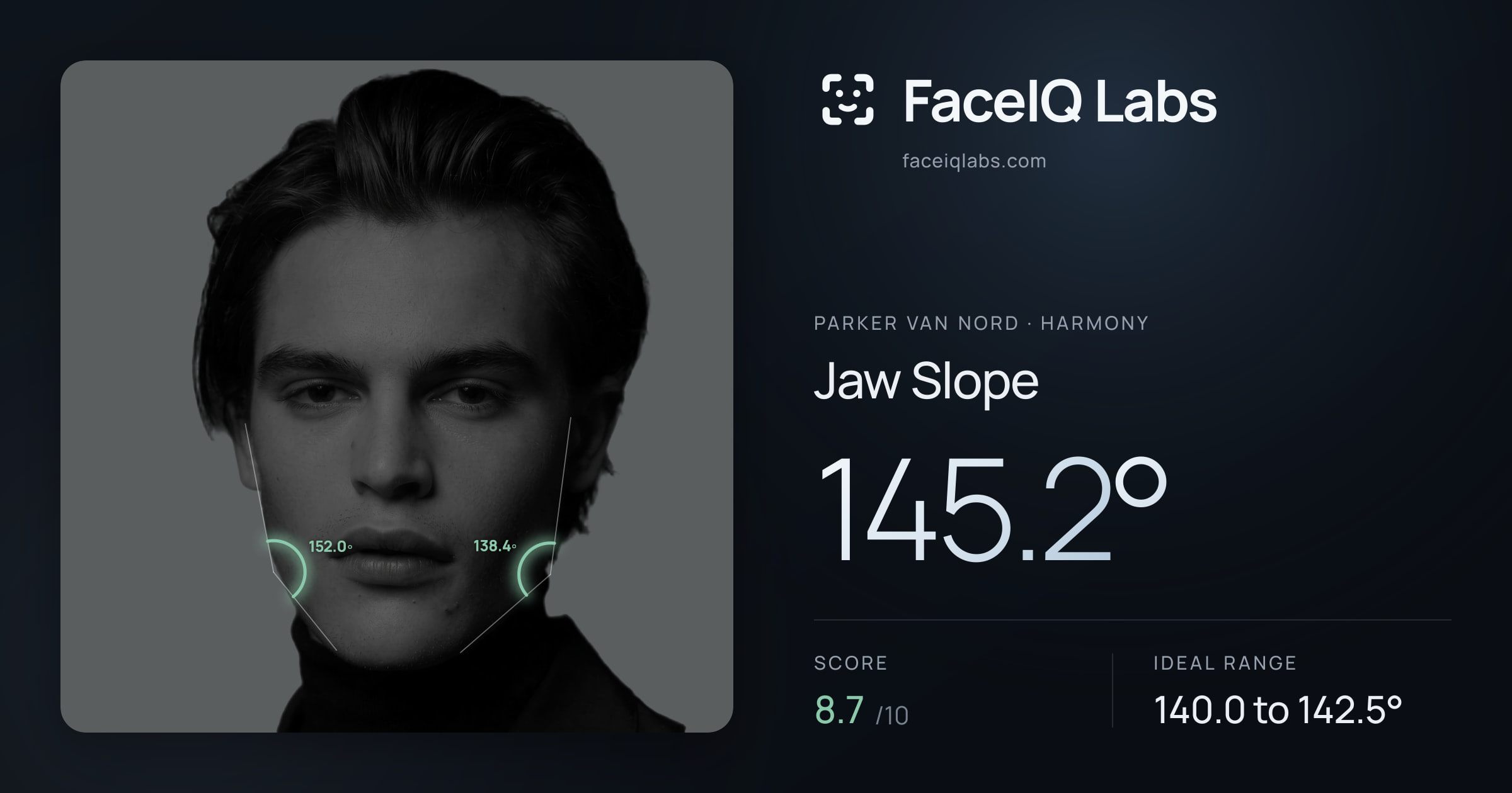 Parker Van Nord Jaw Slope: 145.2°, drawn on the photo