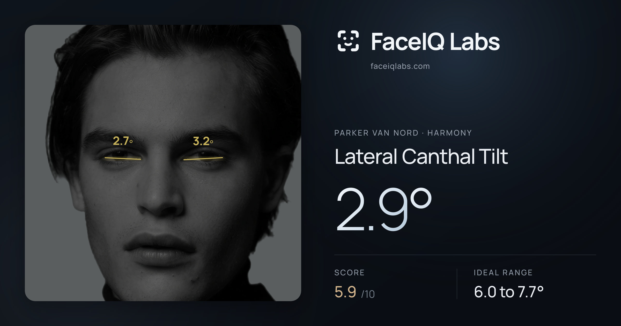 Parker Van Nord Lateral Canthal Tilt: 2.9°, drawn on the photo