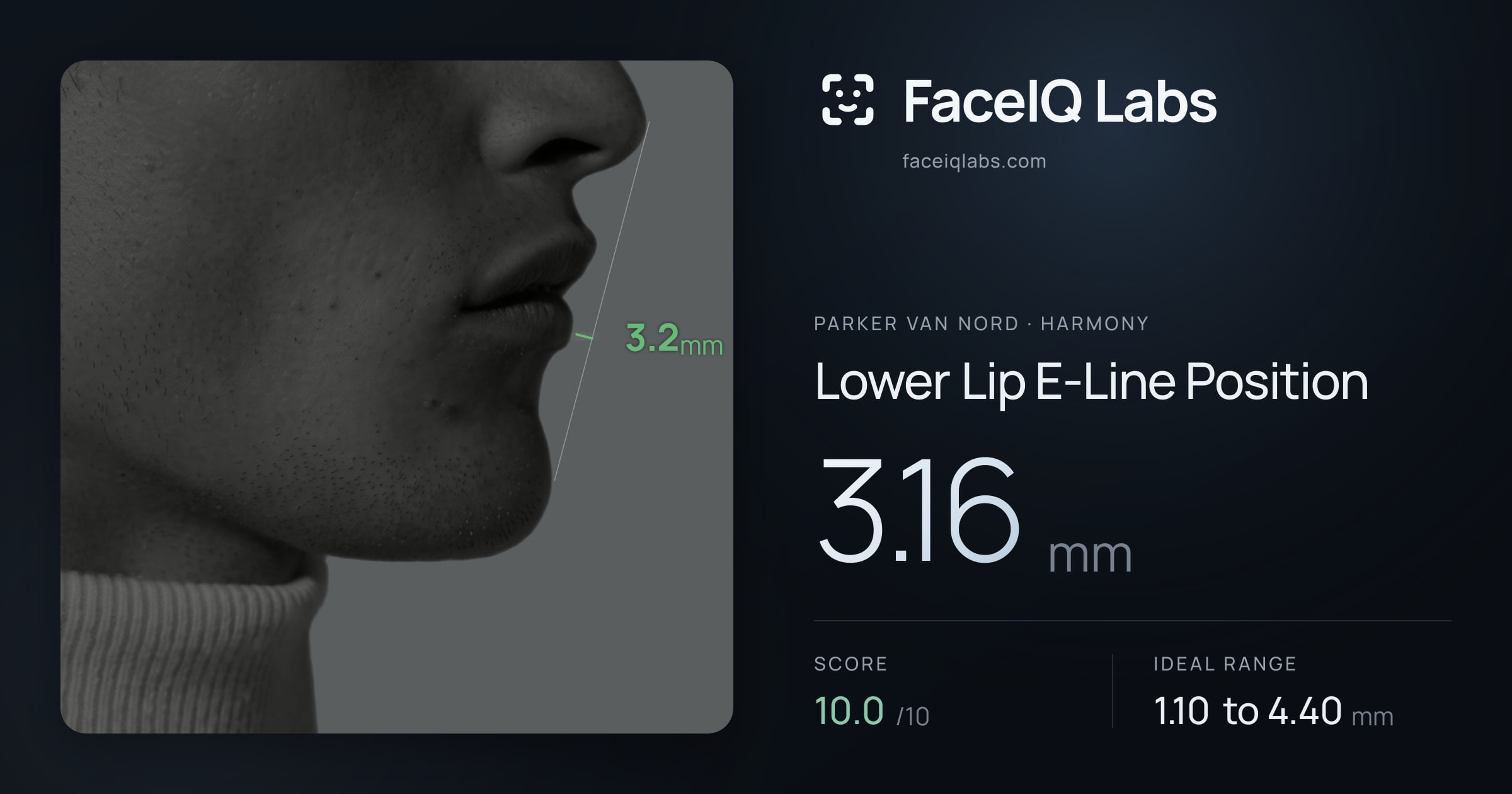 Parker Van Nord Lower Lip E-Line Position: 3.16mm, drawn on the photo