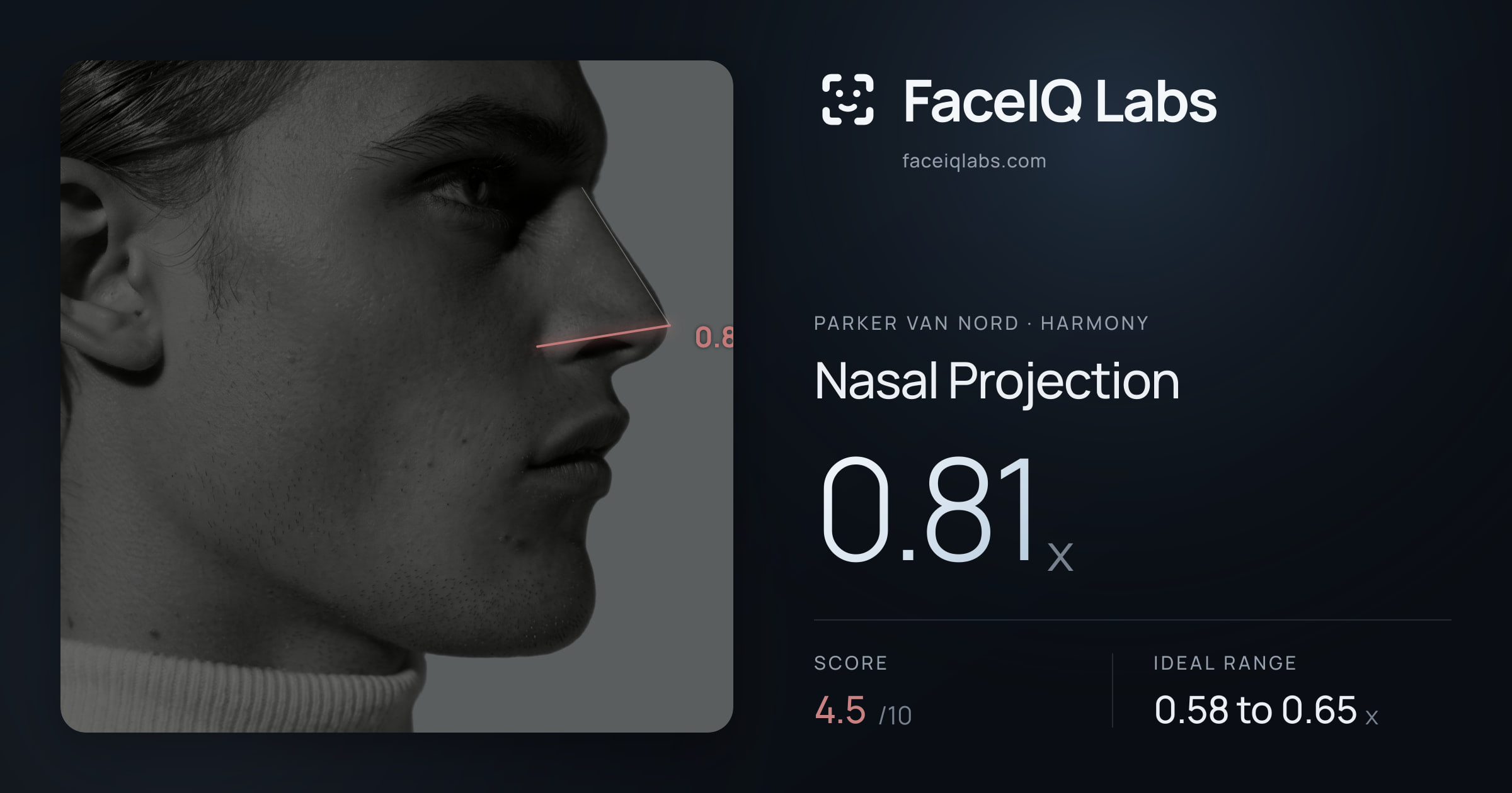 Parker Van Nord Nasal Projection: 0.81x, drawn on the photo