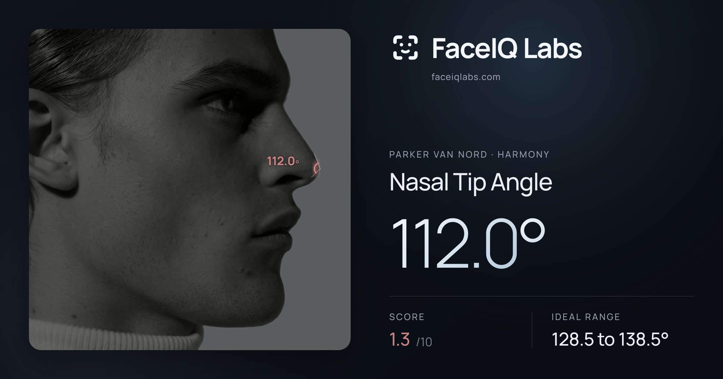 Parker Van Nord Nasal Tip Angle: 112.0°, drawn on the photo
