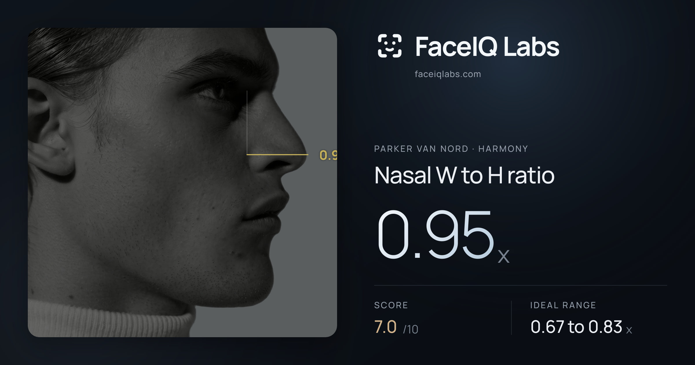 Parker Van Nord Nasal W to H ratio: 0.95x, drawn on the photo