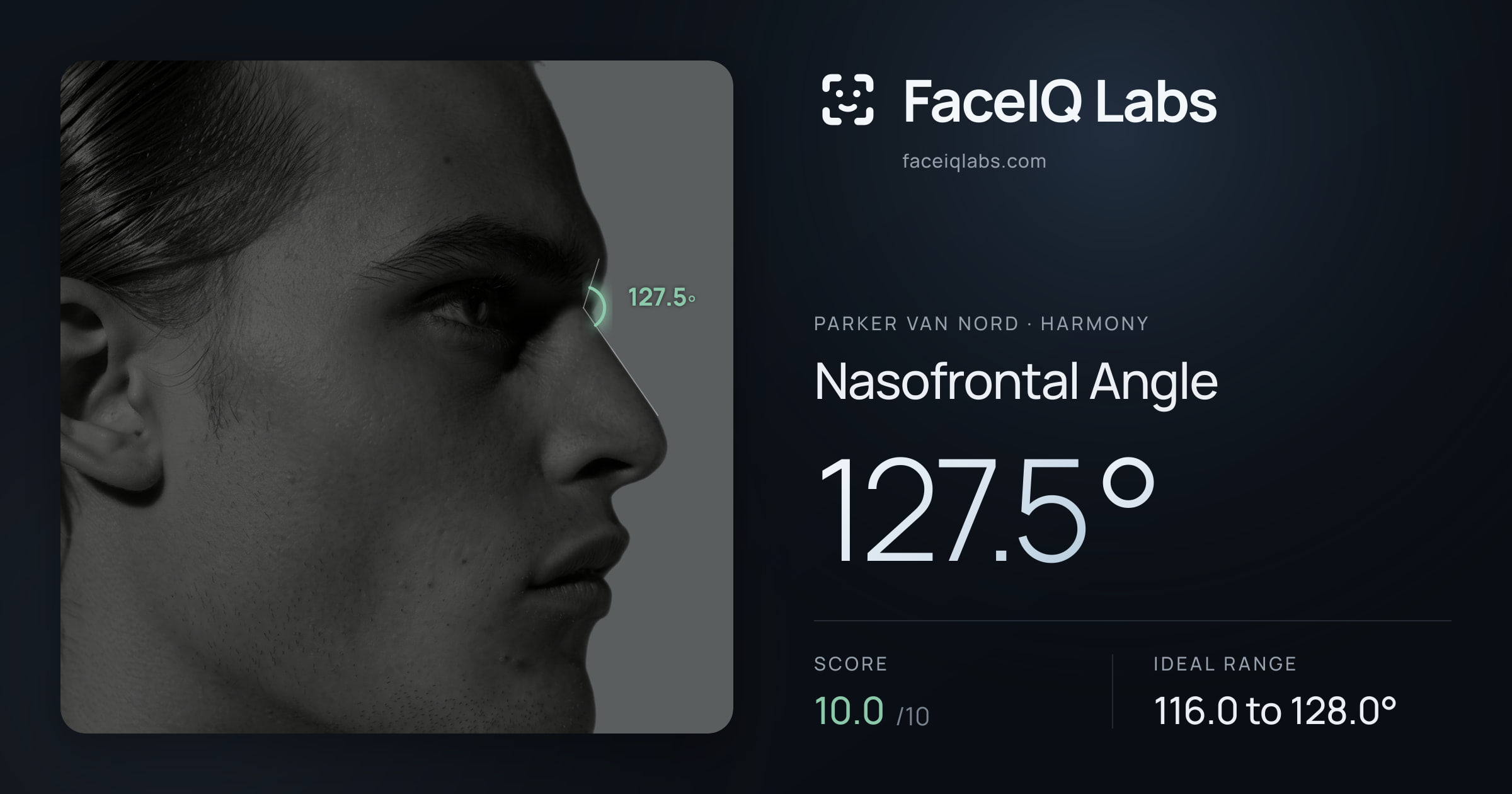 Parker Van Nord Nasofrontal Angle: 127.5°, drawn on the photo