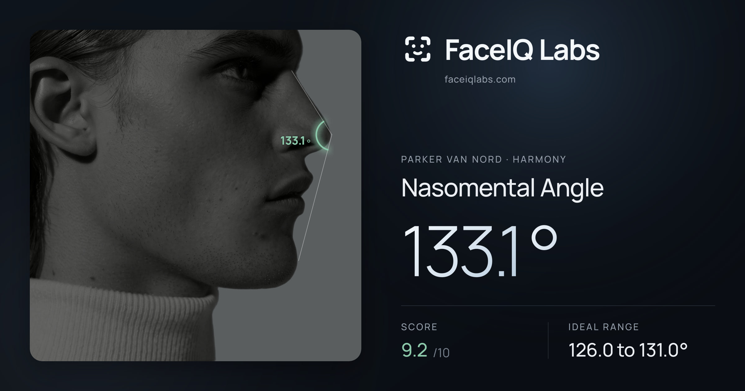 Parker Van Nord Nasomental Angle: 133.1°, drawn on the photo