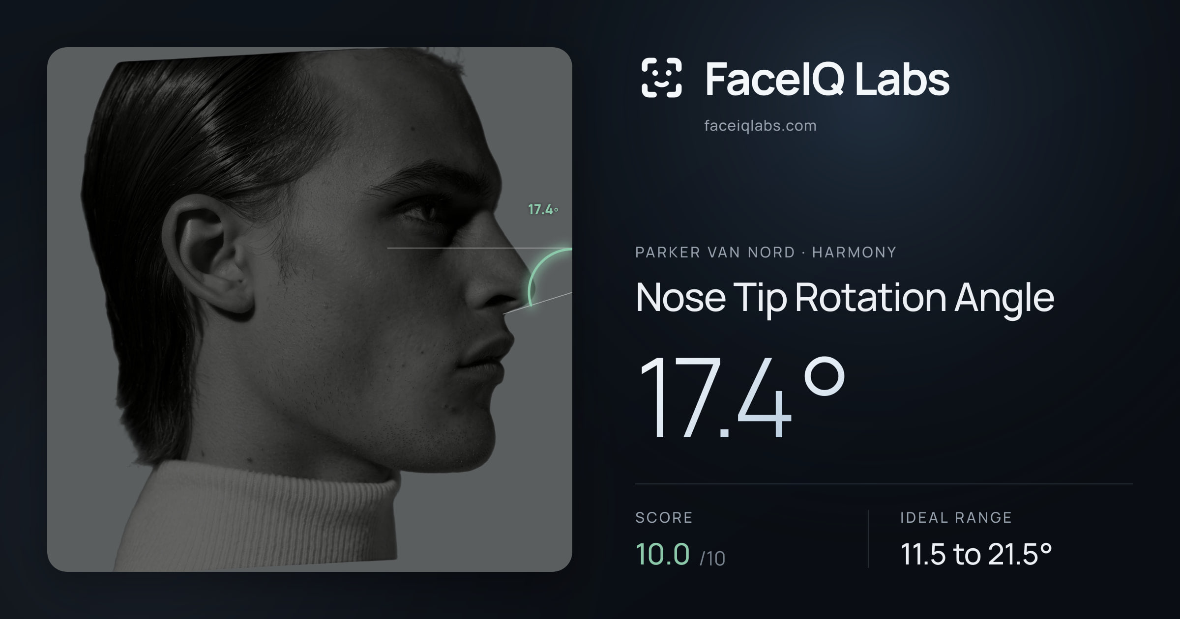 Parker Van Nord Nose Tip Rotation Angle: 17.4°, drawn on the photo