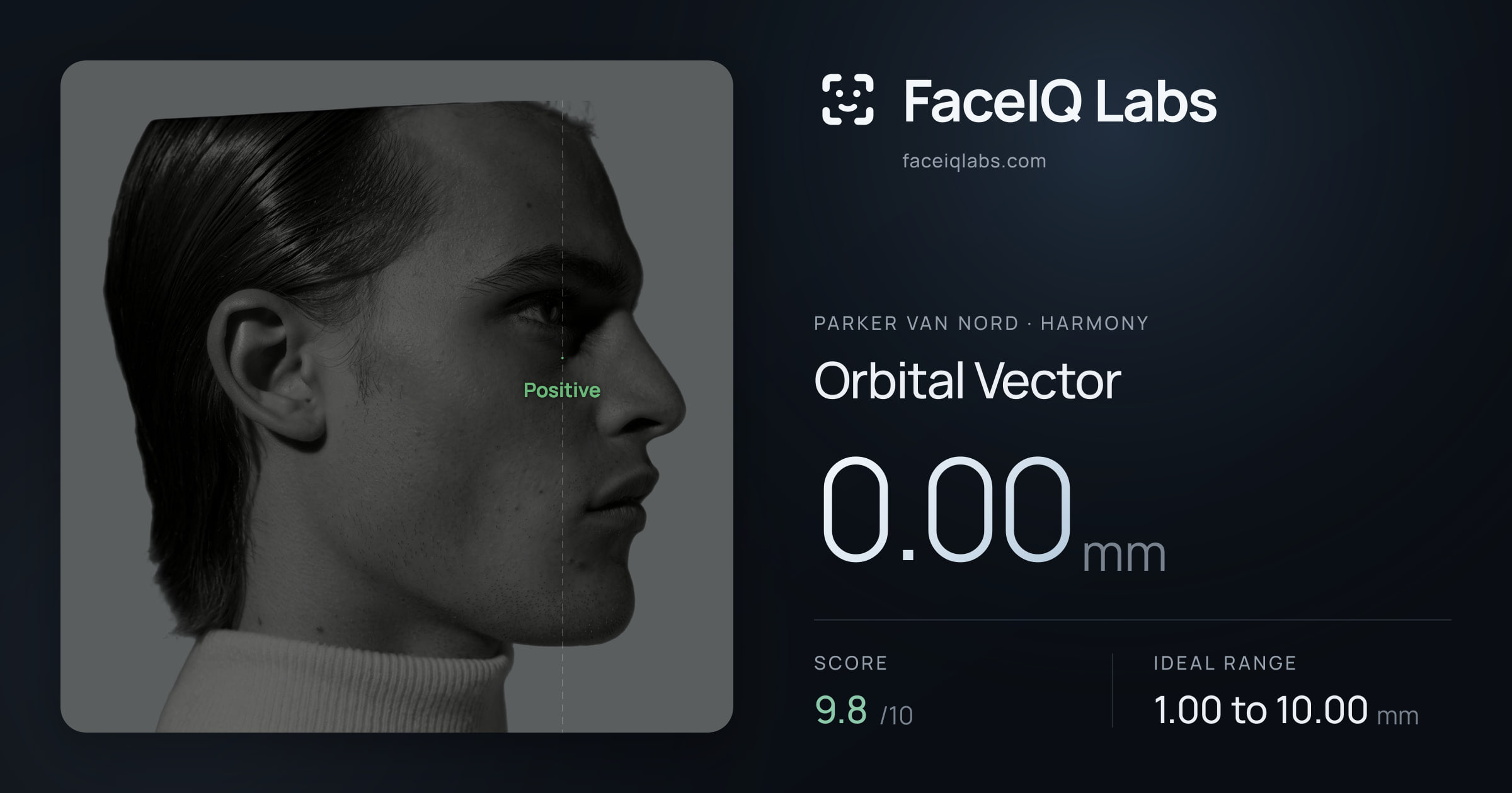Parker Van Nord Orbital Vector: 0.00mm, drawn on the photo