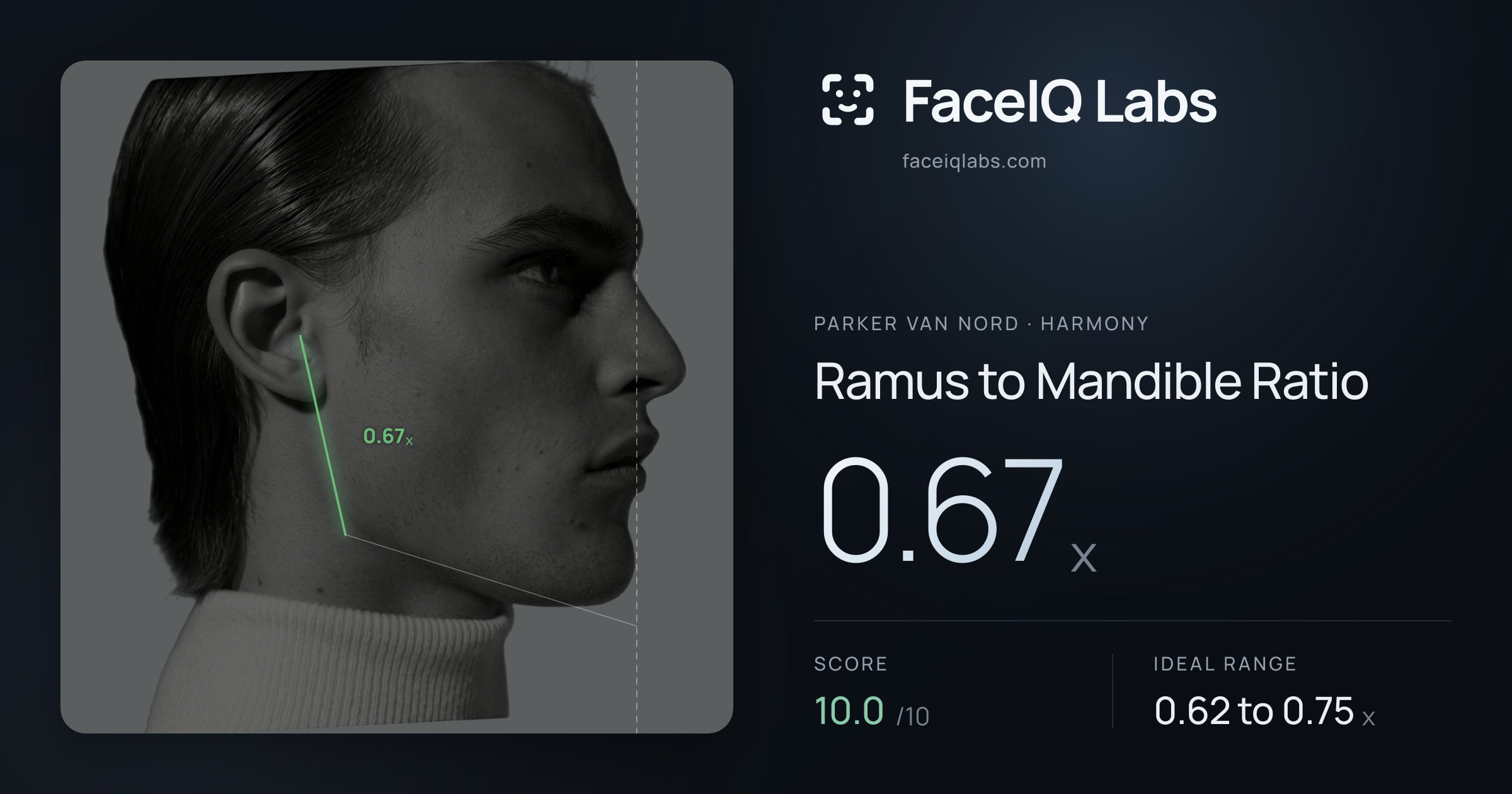 Parker Van Nord Ramus to Mandible Ratio: 0.67x, drawn on the photo