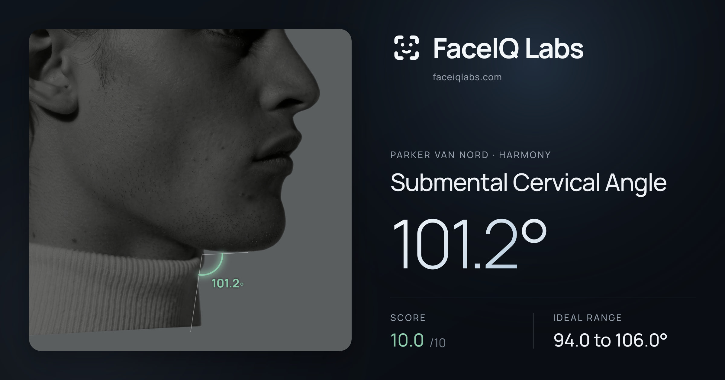 Parker Van Nord Submental Cervical Angle: 101.2°, drawn on the photo