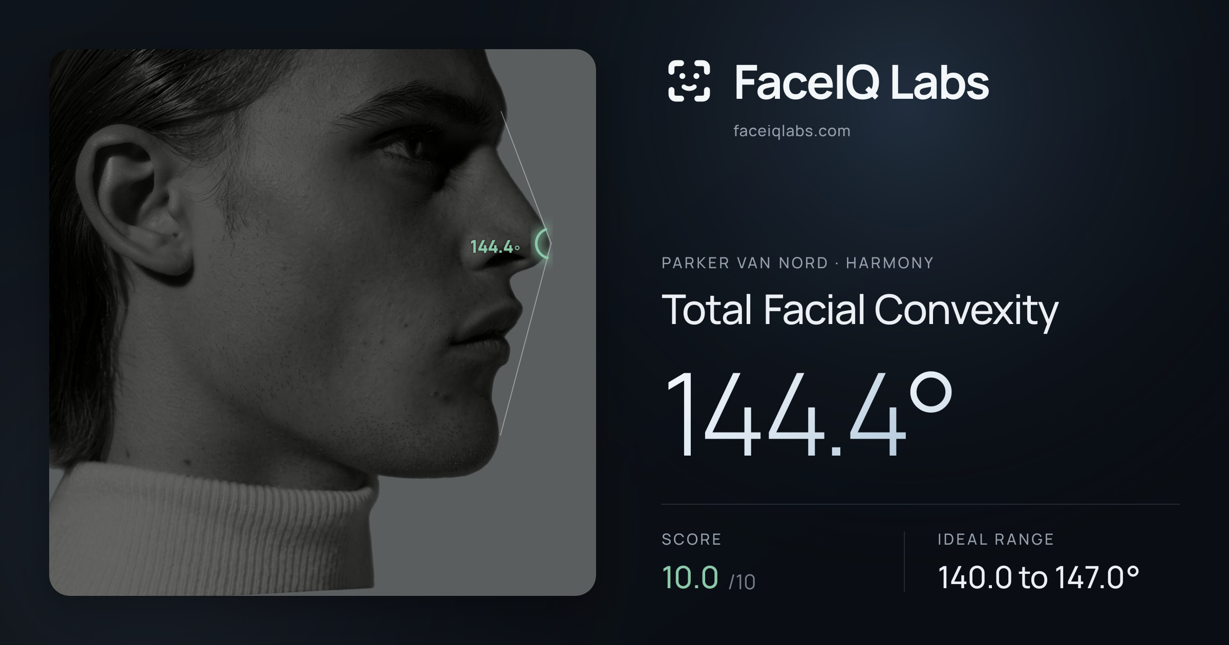 Parker Van Nord Total Facial Convexity: 144.4°, drawn on the photo