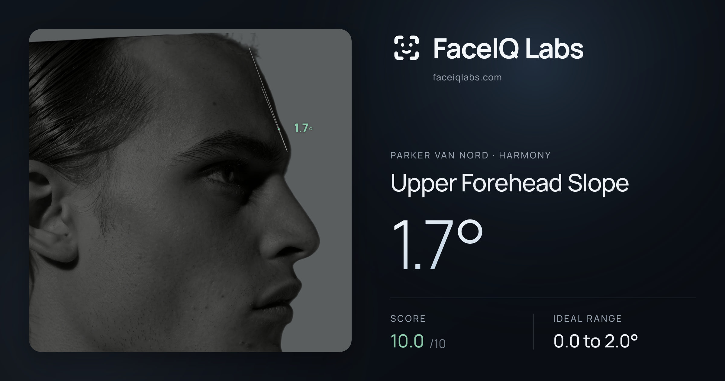 Parker Van Nord Upper Forehead Slope: 1.7°, drawn on the photo