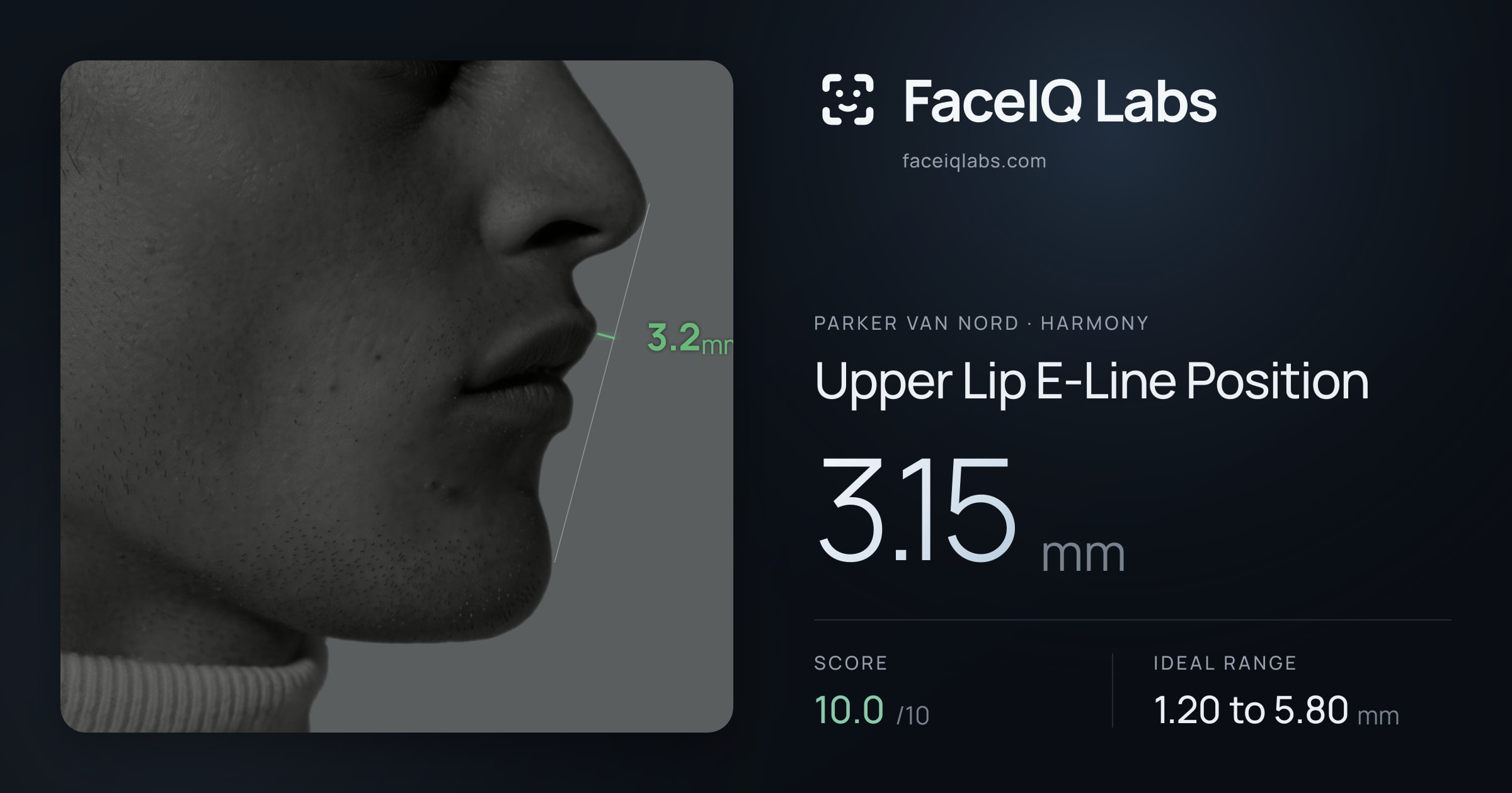 Parker Van Nord Upper Lip E-Line Position: 3.15mm, drawn on the photo