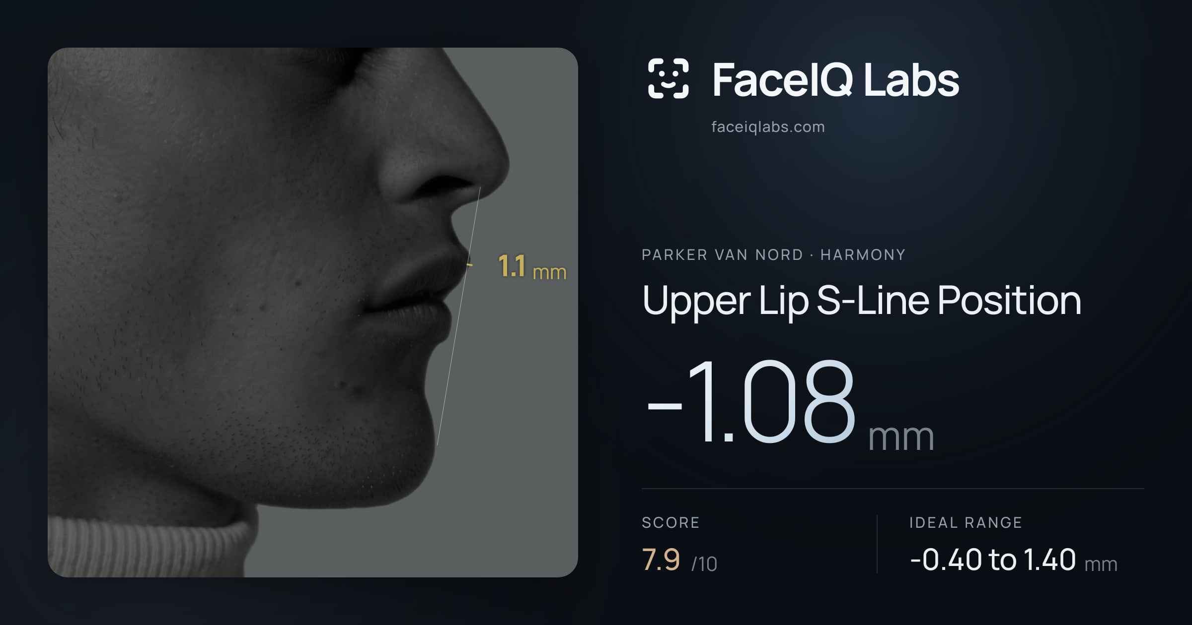 Parker Van Nord Upper Lip S-Line Position: -1.08mm, drawn on the photo