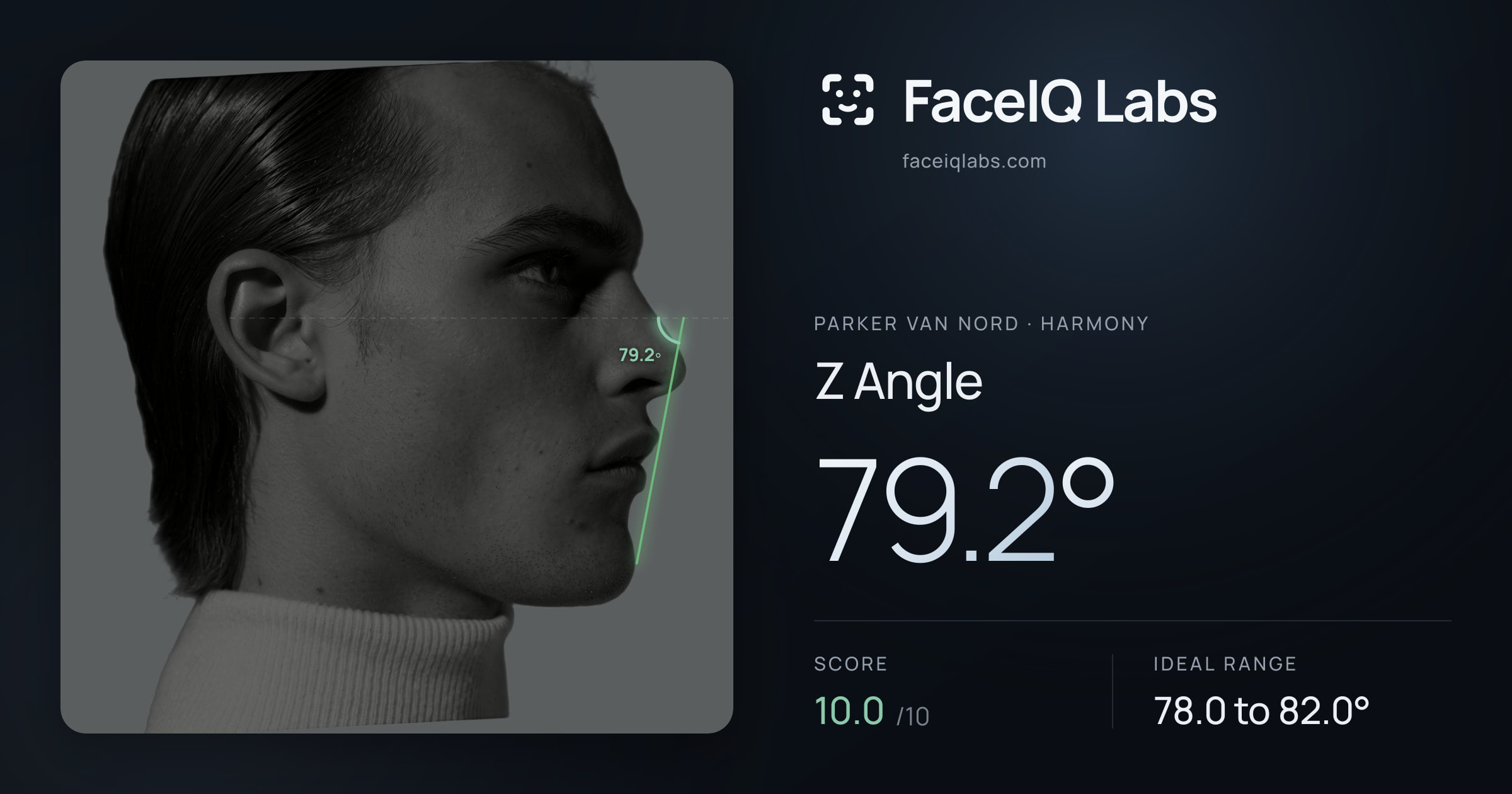Parker Van Nord Z Angle: 79.2°, drawn on the photo